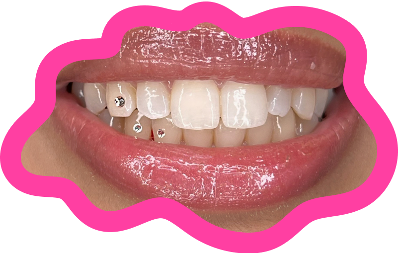 Tooth Gems — Vancity Beauty Lounge