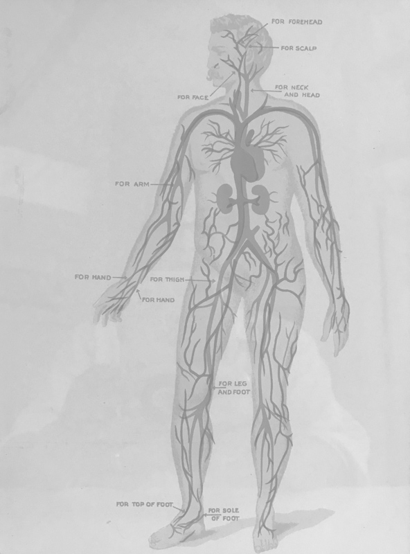 Body Diagram