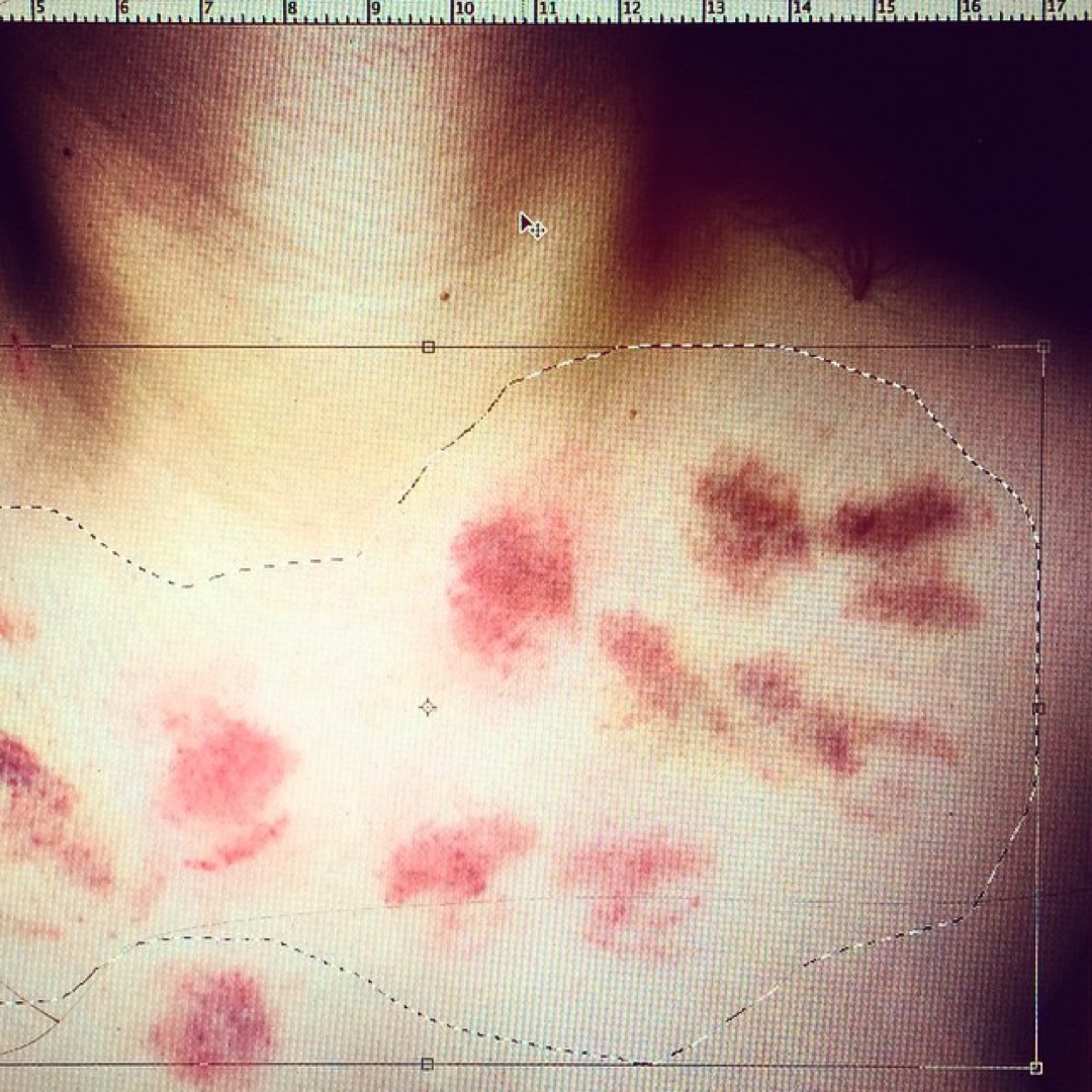 all the hickies were captured from the internet