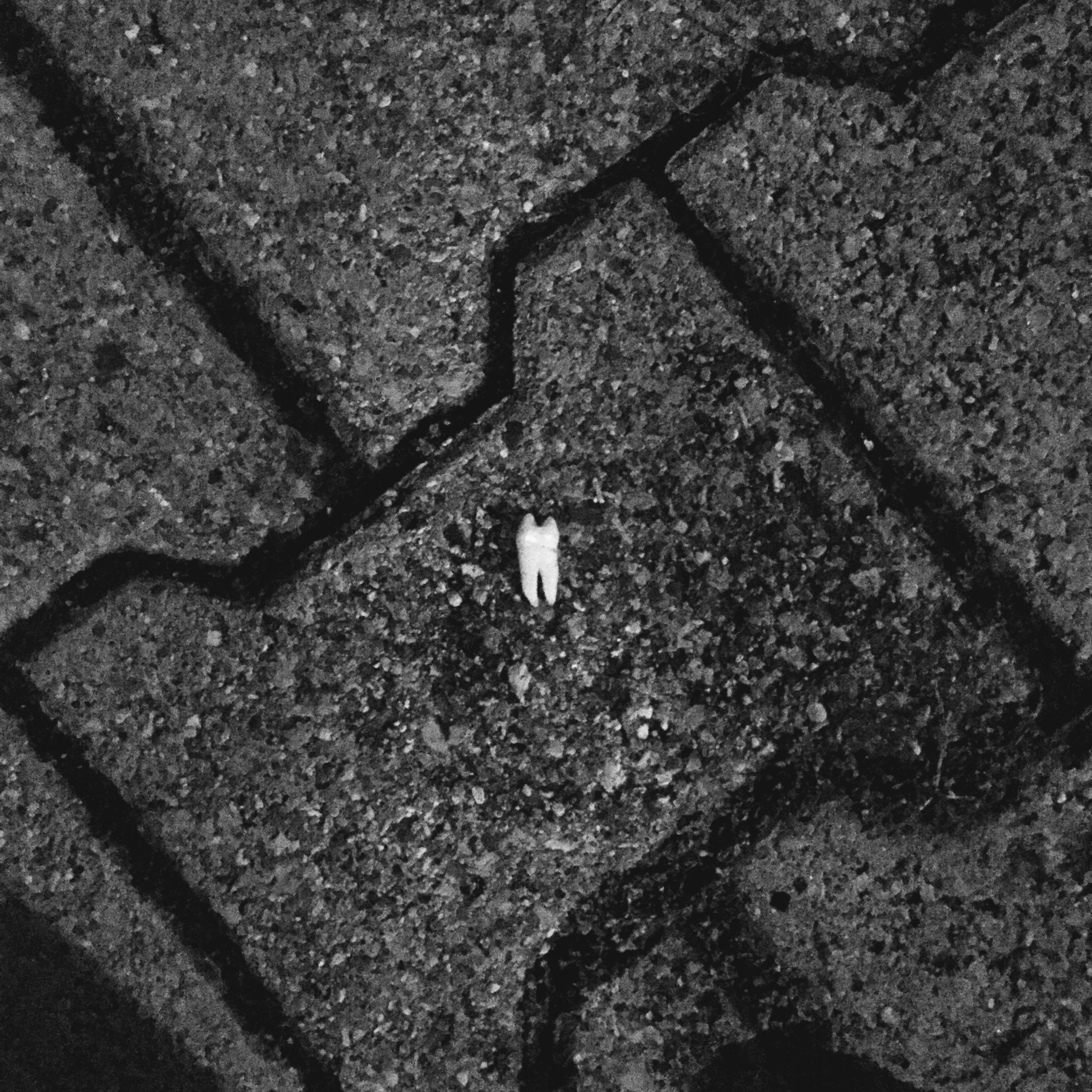 Trovare un dente umano in cortile, Bologna, 29-5-16