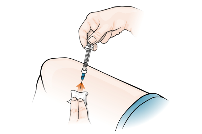 Remove needle/apply pressure