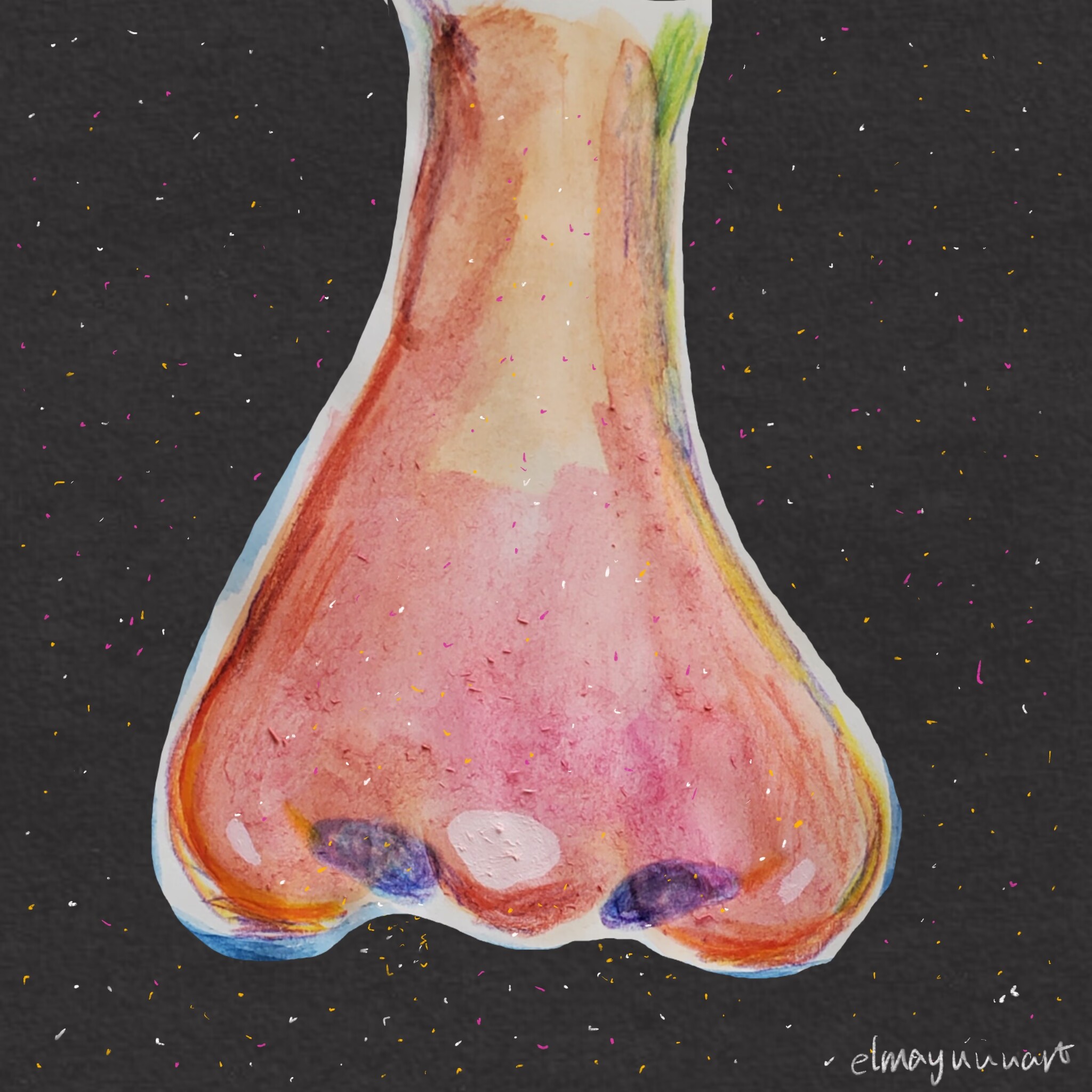 Allergic rhinitis(Personal project)