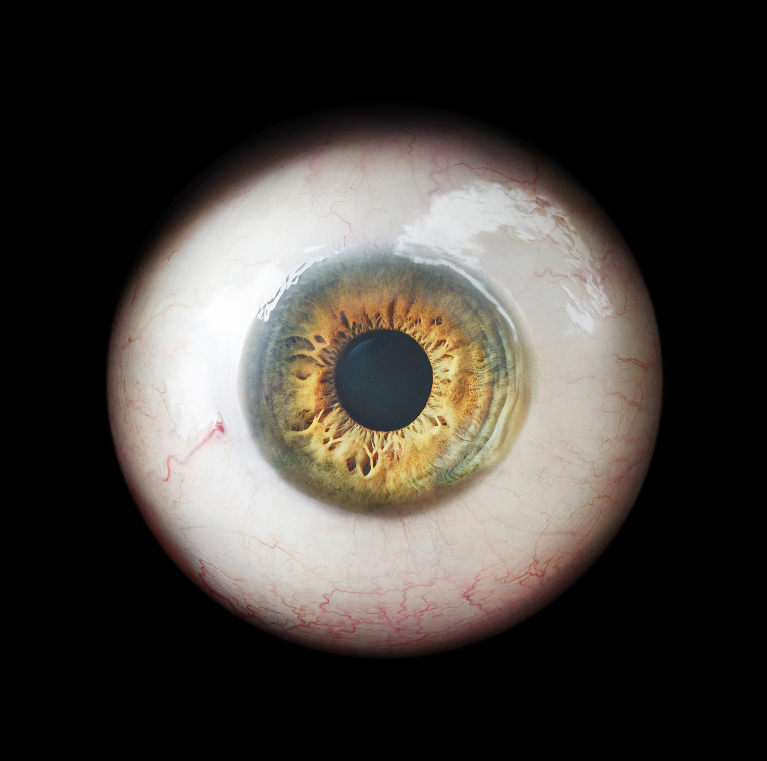 OPHTHALM/OS