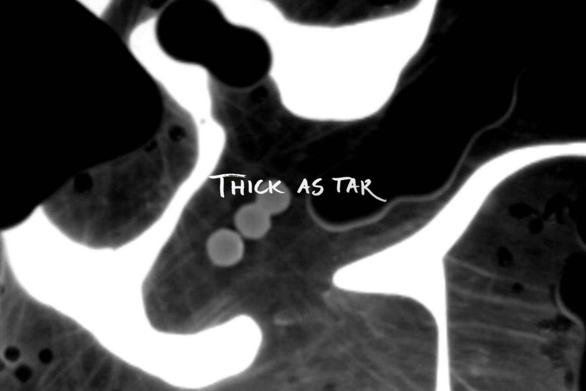 Shortfilm about Stealthing ↘