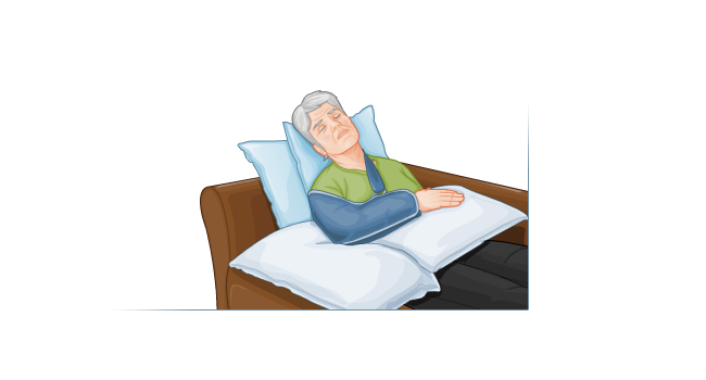 Propping arm up after surgery