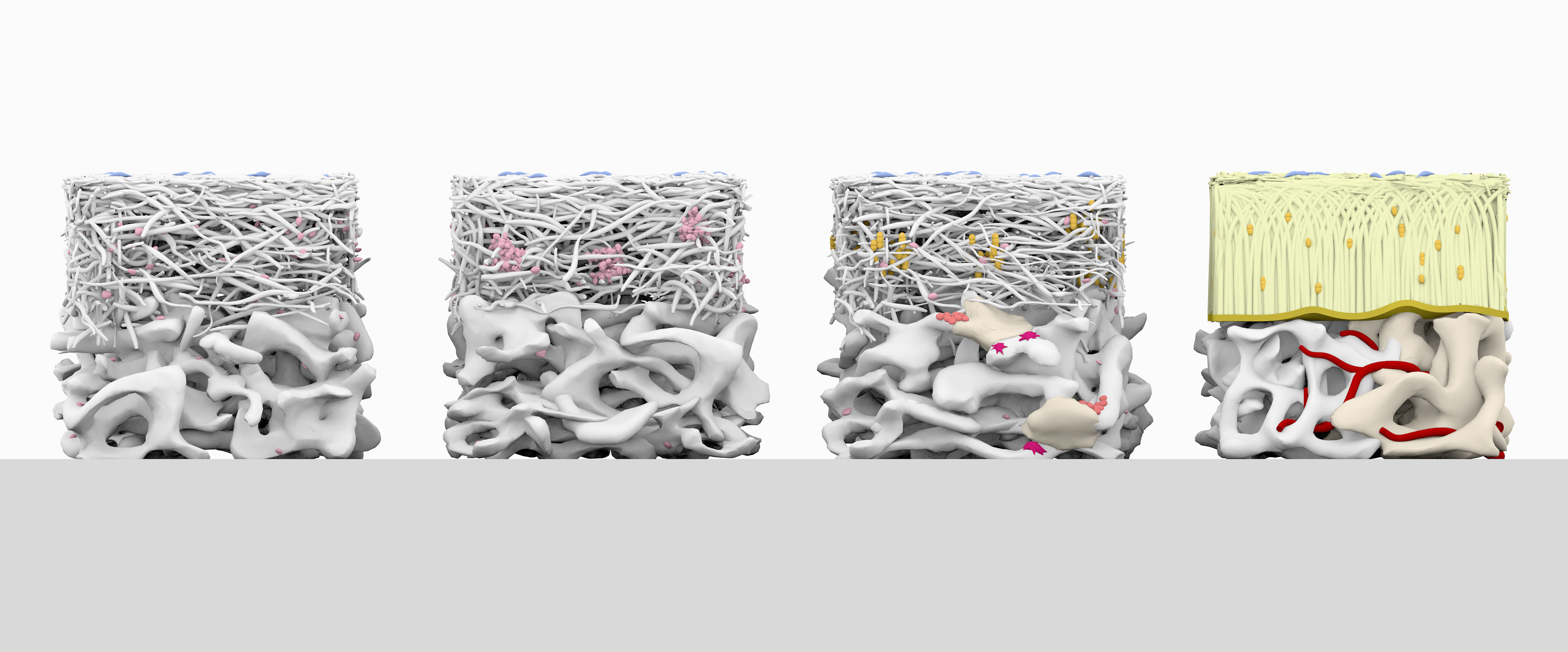Rendered preview of the set: Four stages of soft and hard tissue regeneration with Geistlich Biomaterials.