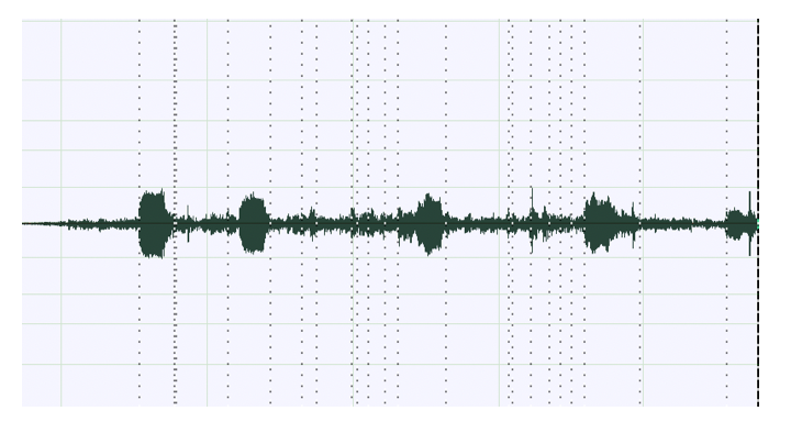 a. periodic noise, beeps of an elevator
