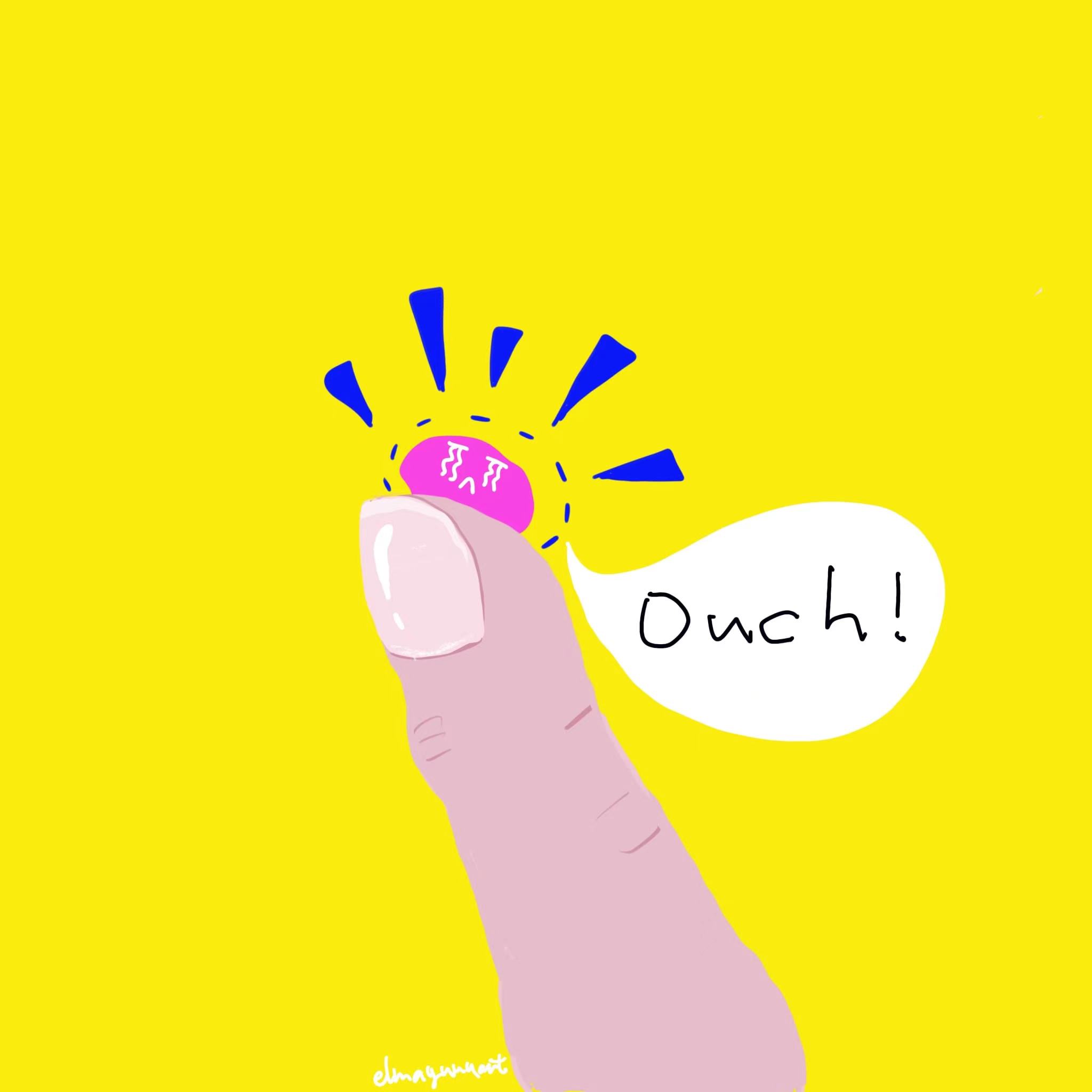 My diary - 22 Feb. 2023 - the thumb was accidentally burned by the fire last night😩, have a blister now