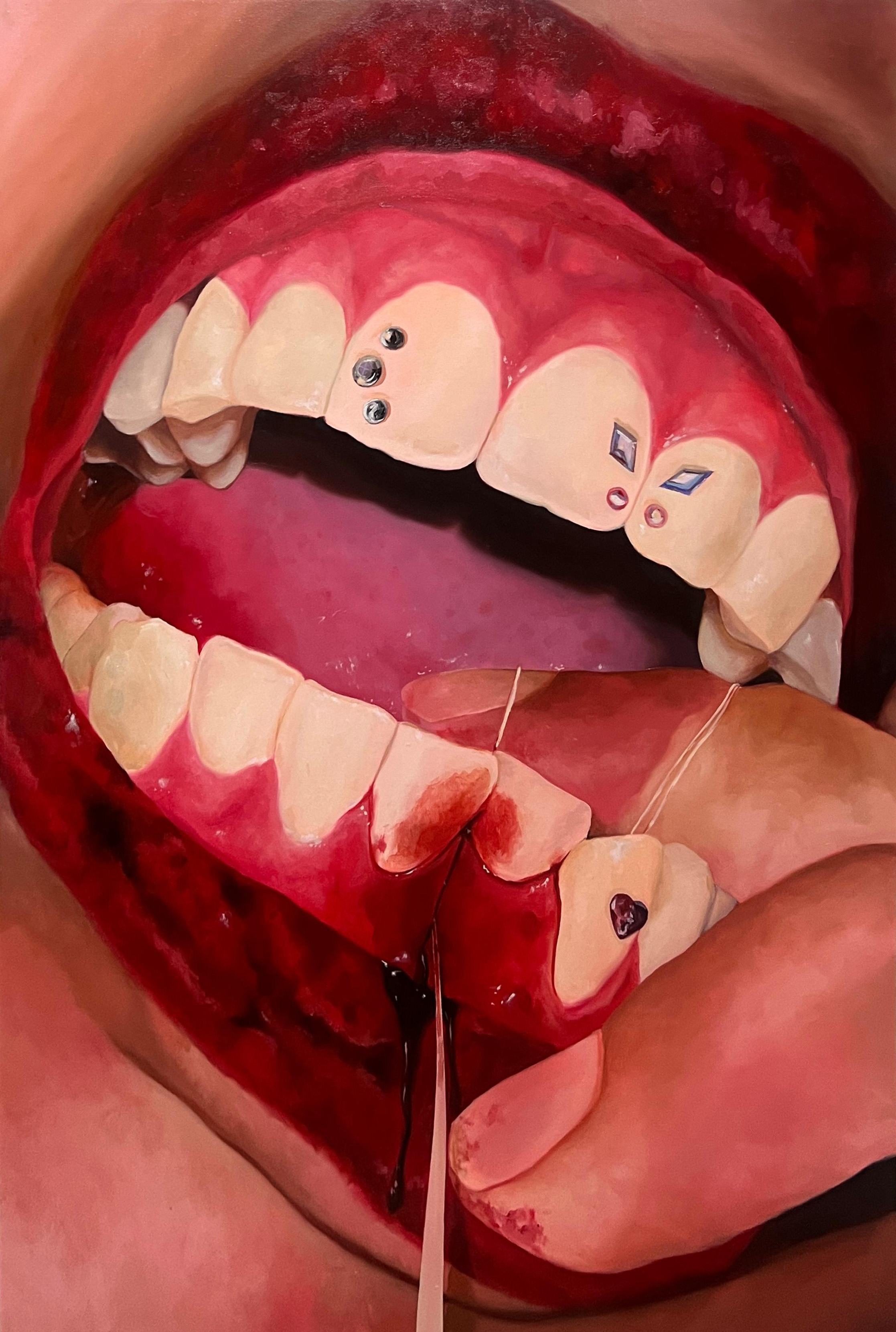 Lustre and Lesion #3: Cherry String