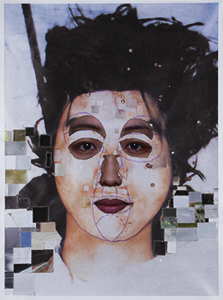 [IMAGE] After Aesthetic Surgery