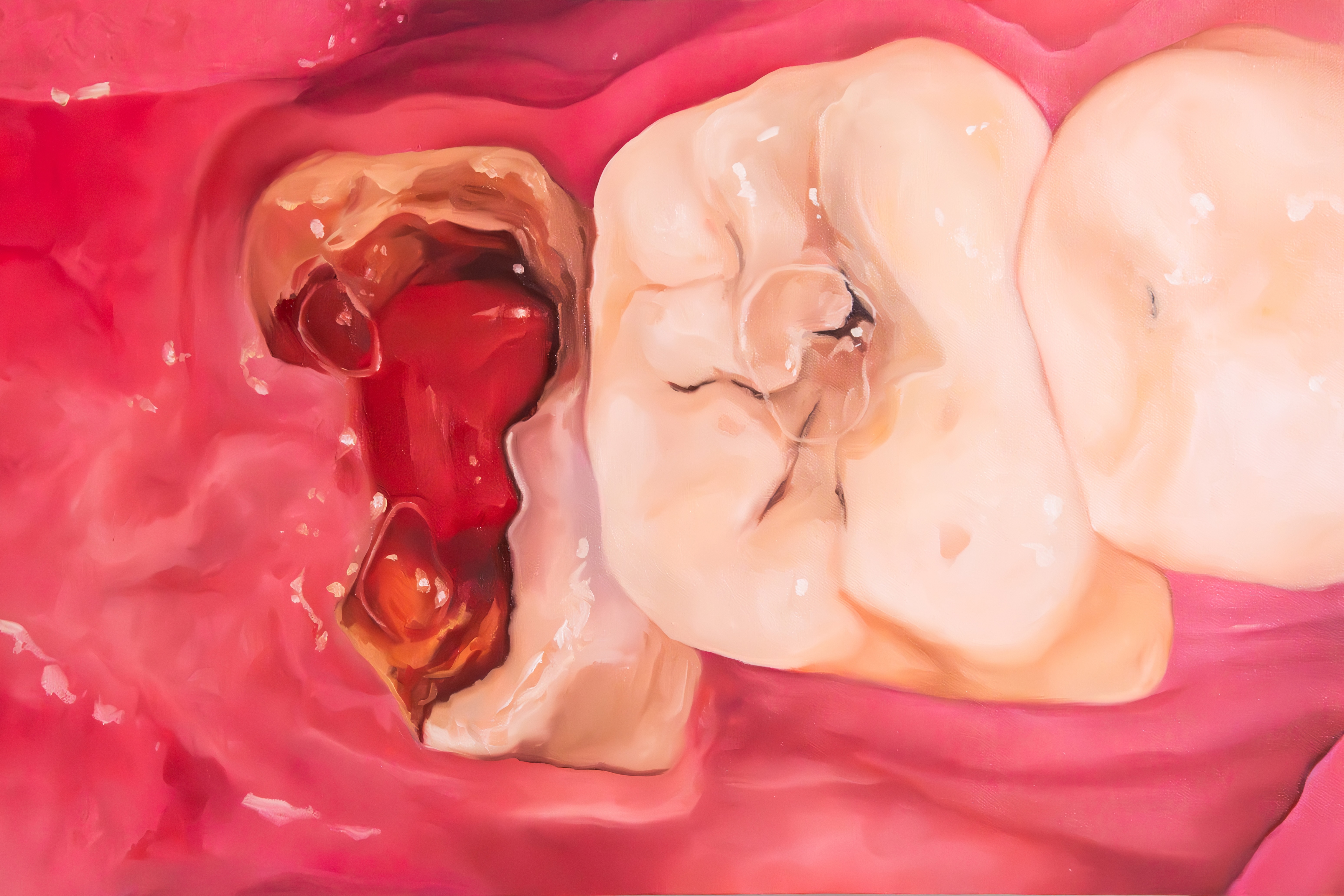 Bite Record #1: Open Pulp