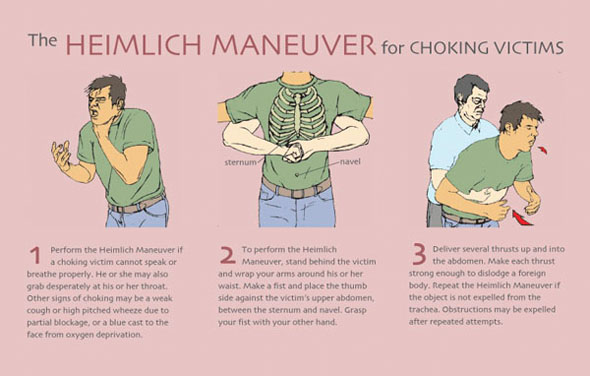 The Heimlich Maneuver.jpg