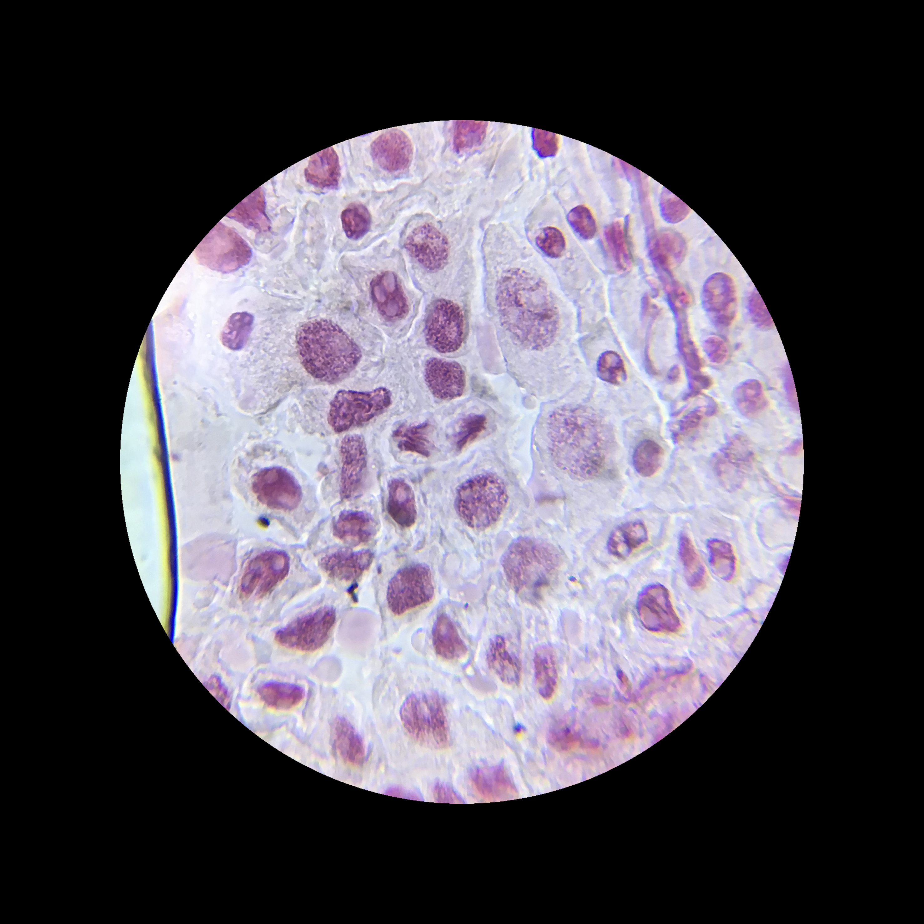 Mitosis