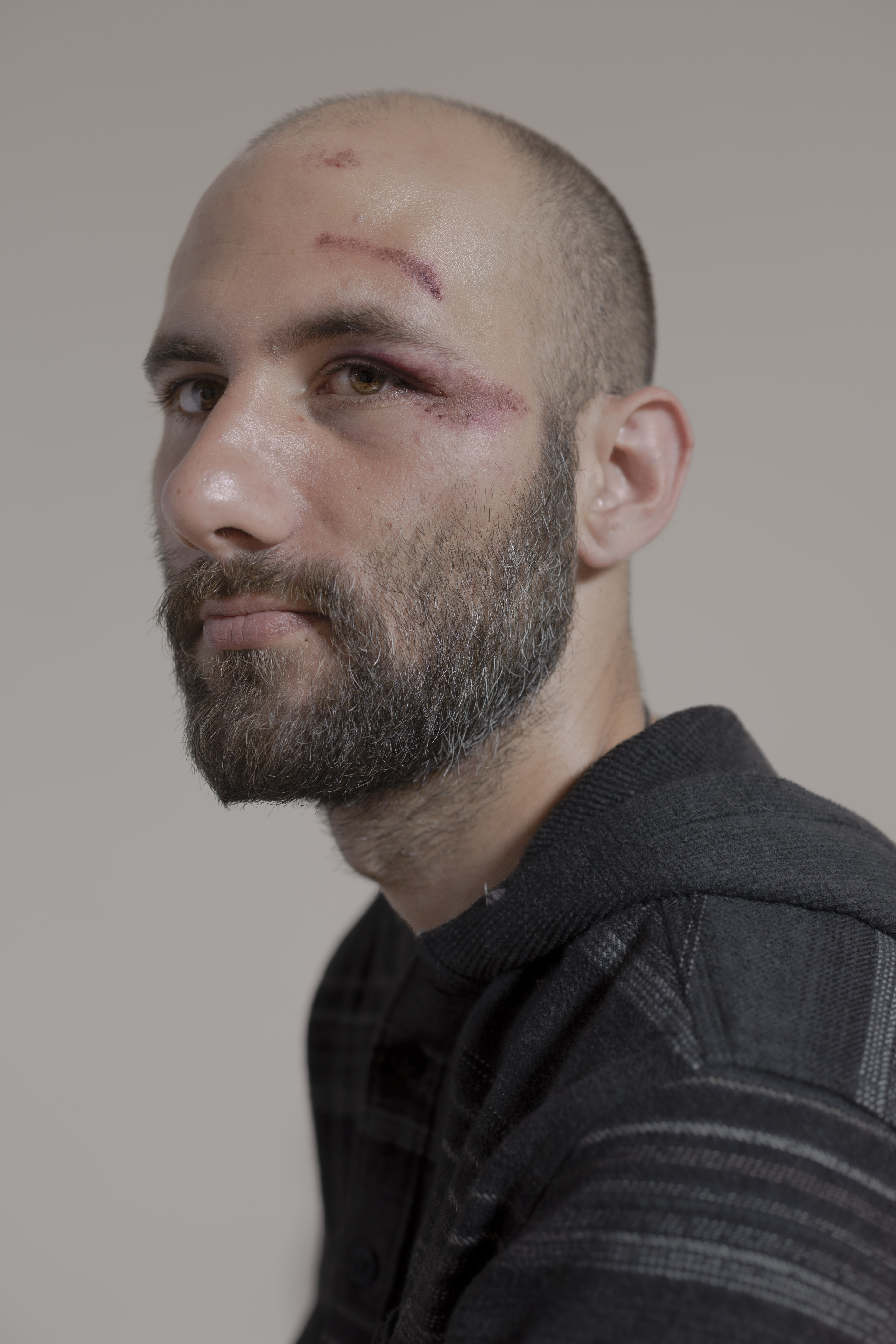 Arne R. after he was attacked on his way home