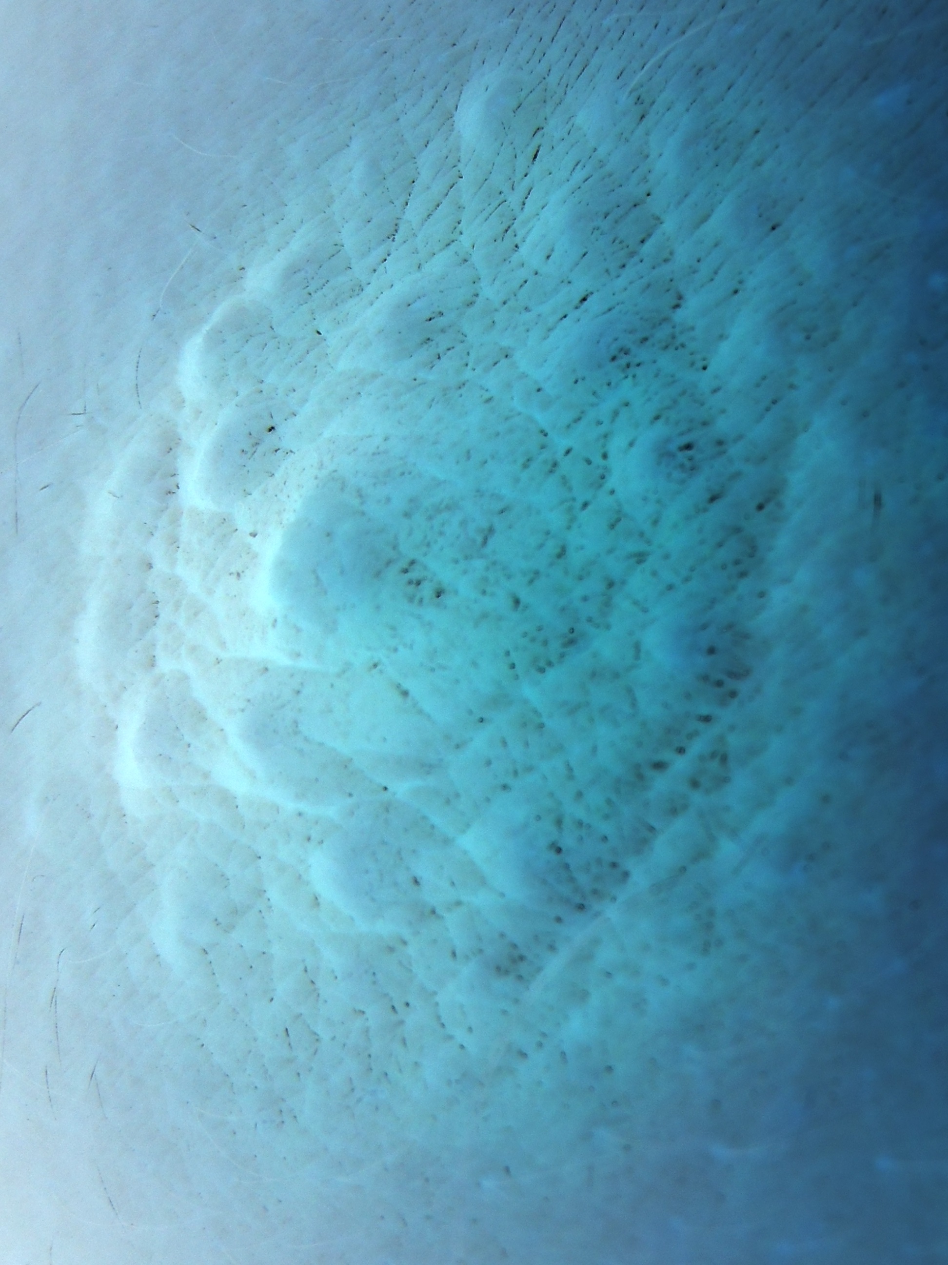 Evidence, 2018