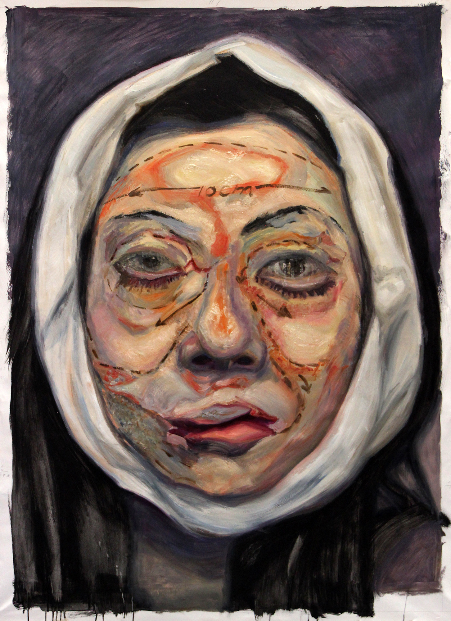 Double Faces Pre & Post Cosmetic Surgery-2, 2016, oil on canvas, 150 × 124.5 cm (59 × 49 in)