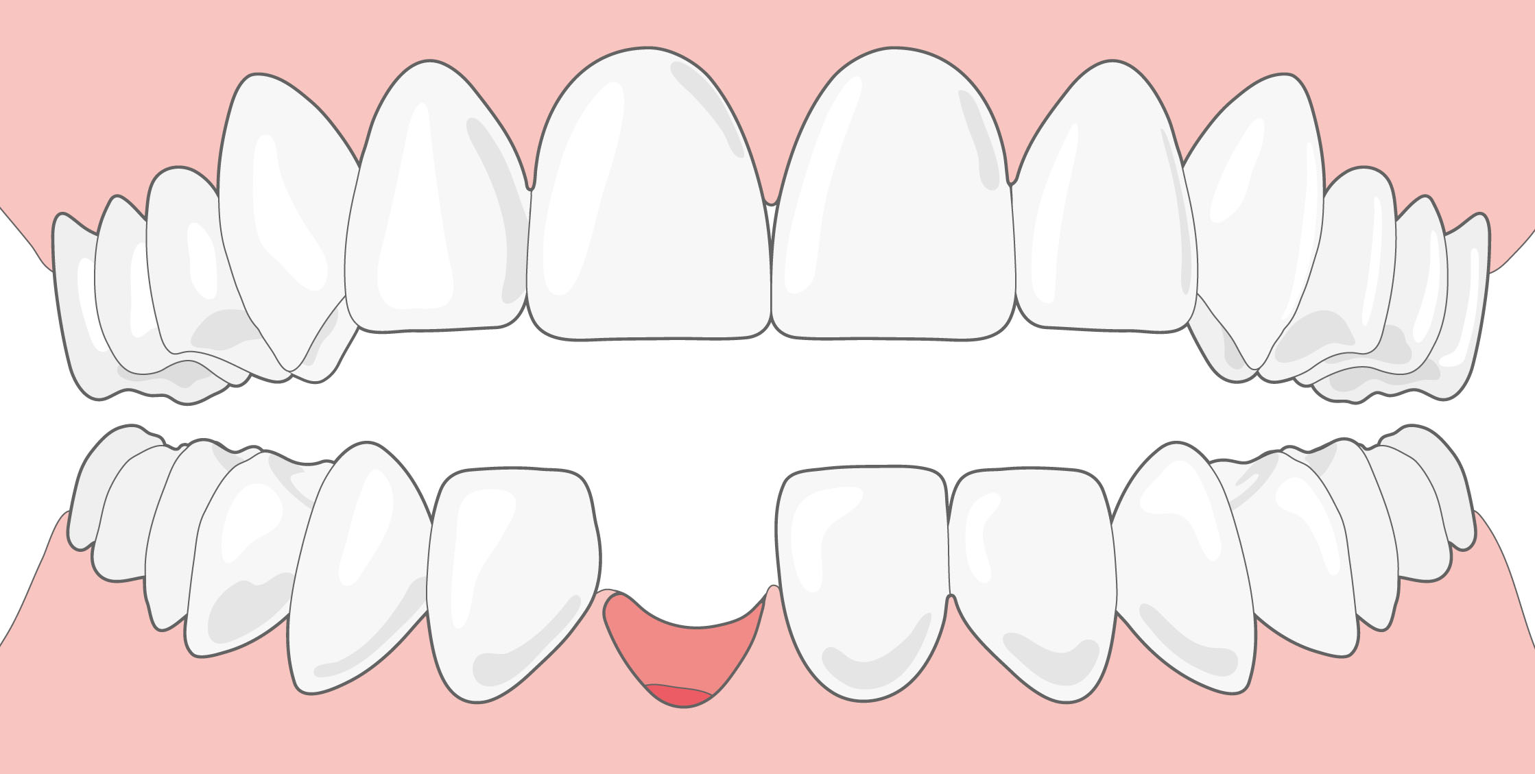 Different Types of Teeth and Their Functions
