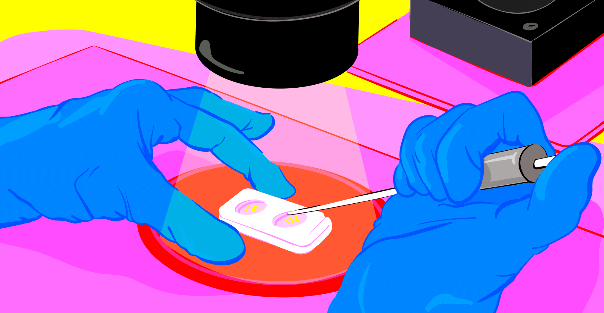 La Vanguardia / Embryo Implantation / 2023