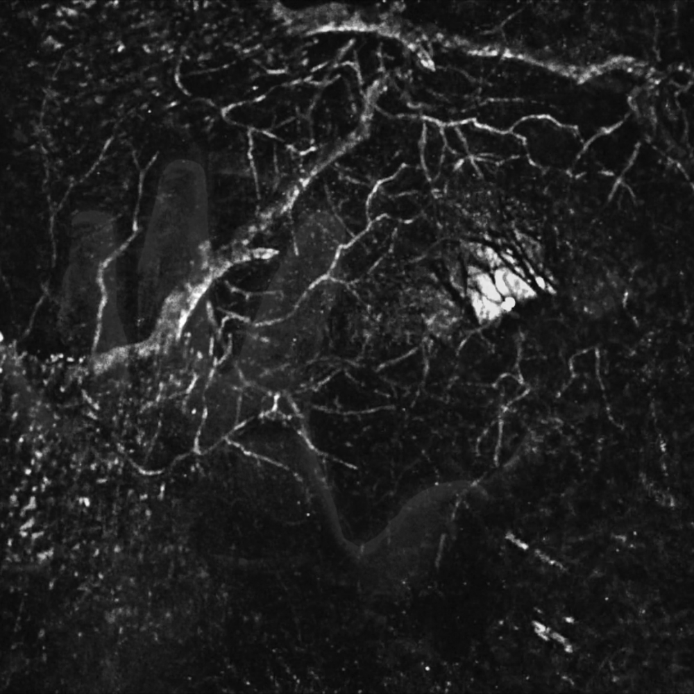 The Sadness of the Trees (2015), Directed by Scott Barley, Mikel Guillen