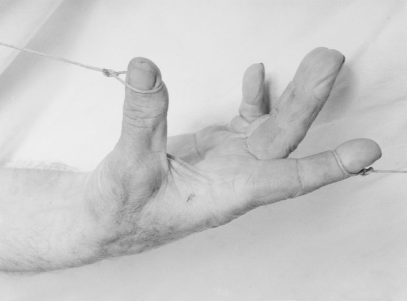 Edgar Martins, Self-inflicted injuries sustained in a suicide attempt by a male involving a knife, 1968