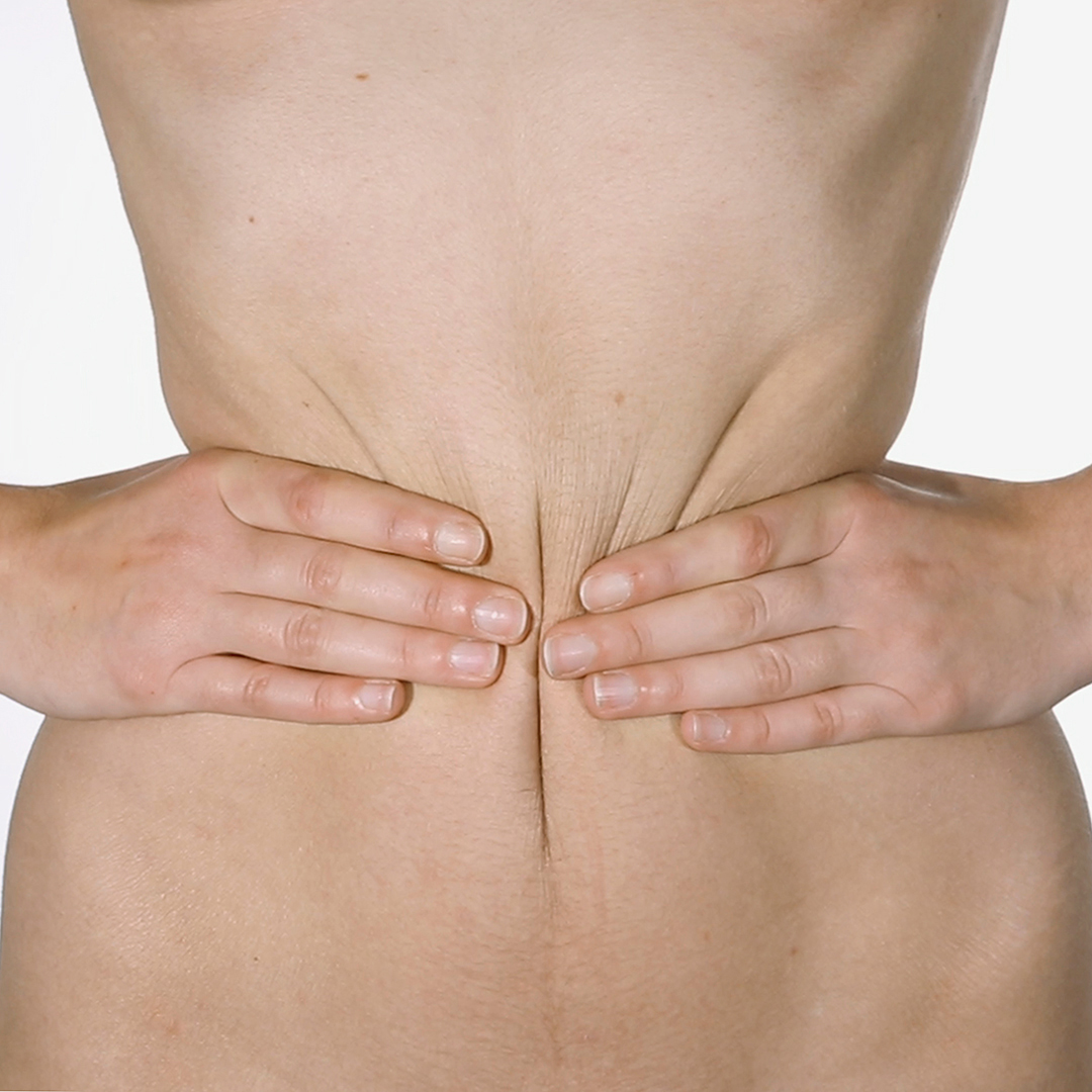 Mon corps anorexique / Compressions