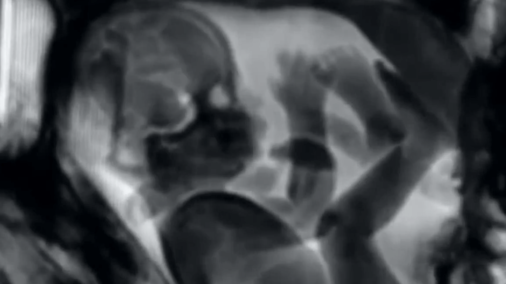 рентген с членом во рту фото 41