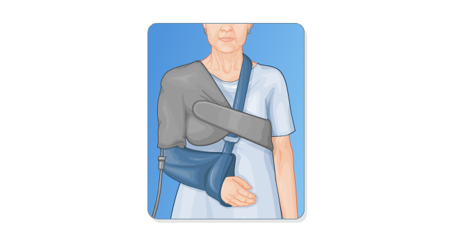Shoulder in sling after surgery, with cold machine