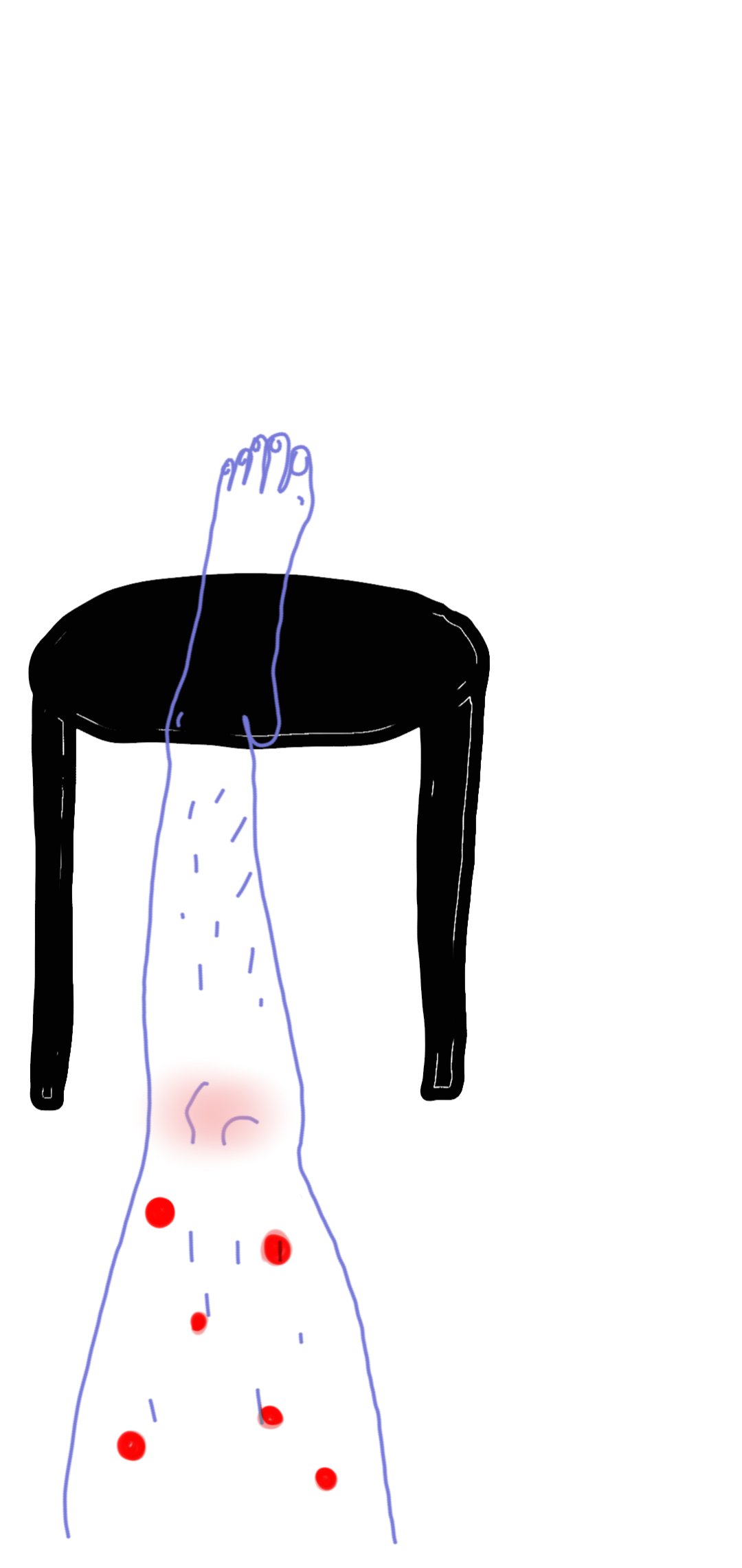 I hate the mosquitoes！！