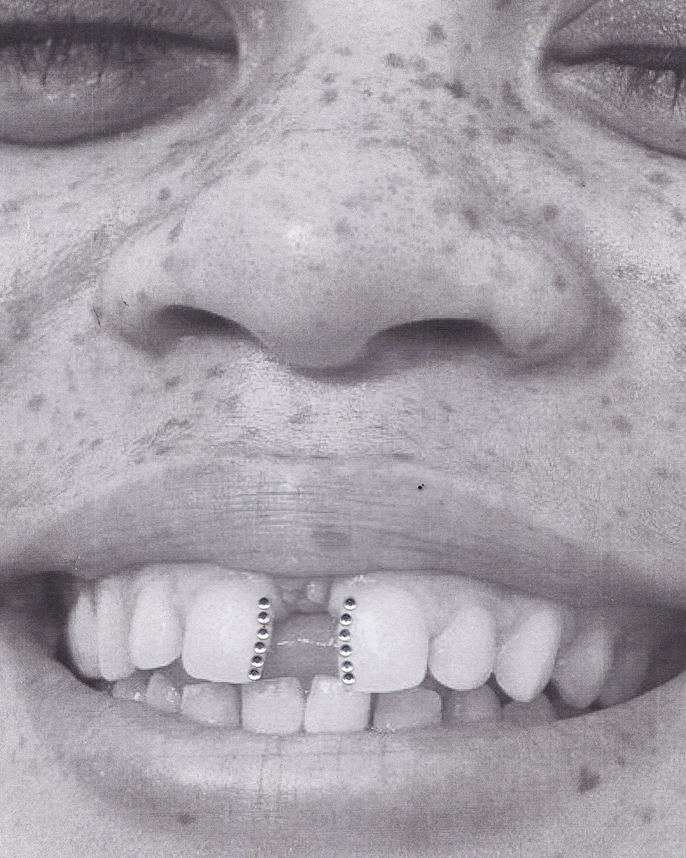 Gap-embracing graphical design containing two vertical lines of crystals