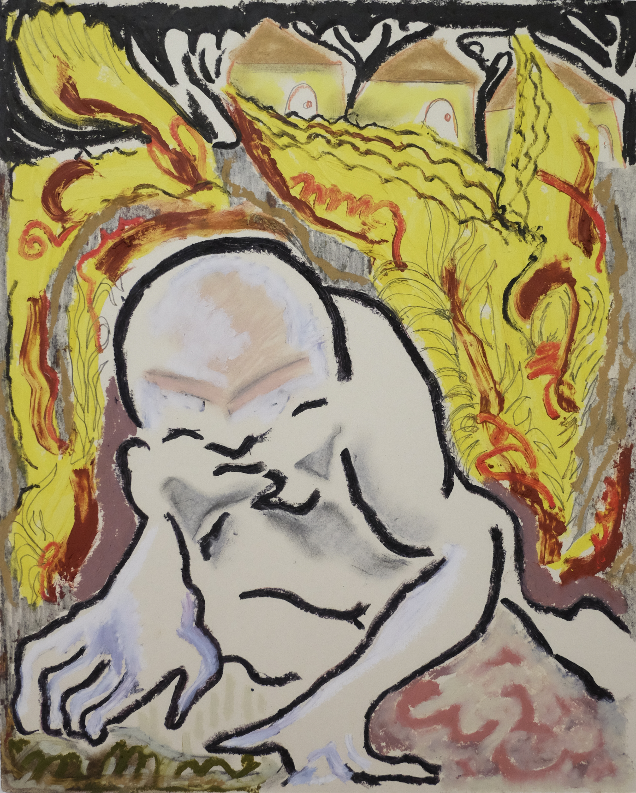 brûlure (le courriel de JAMA), 16 x 20 in.