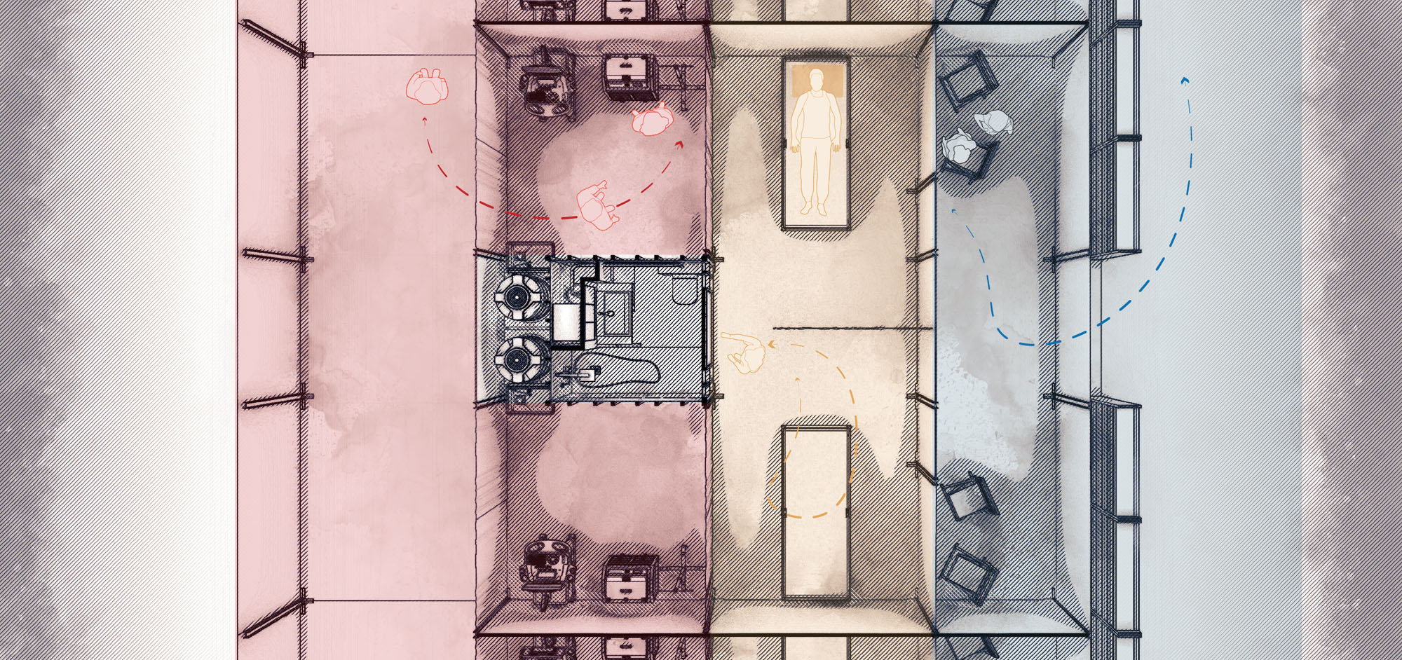 ICU SEPARATION ZONES