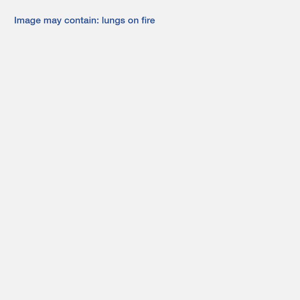 A grey square with blue text that says "Image may contain: lungs on fire"