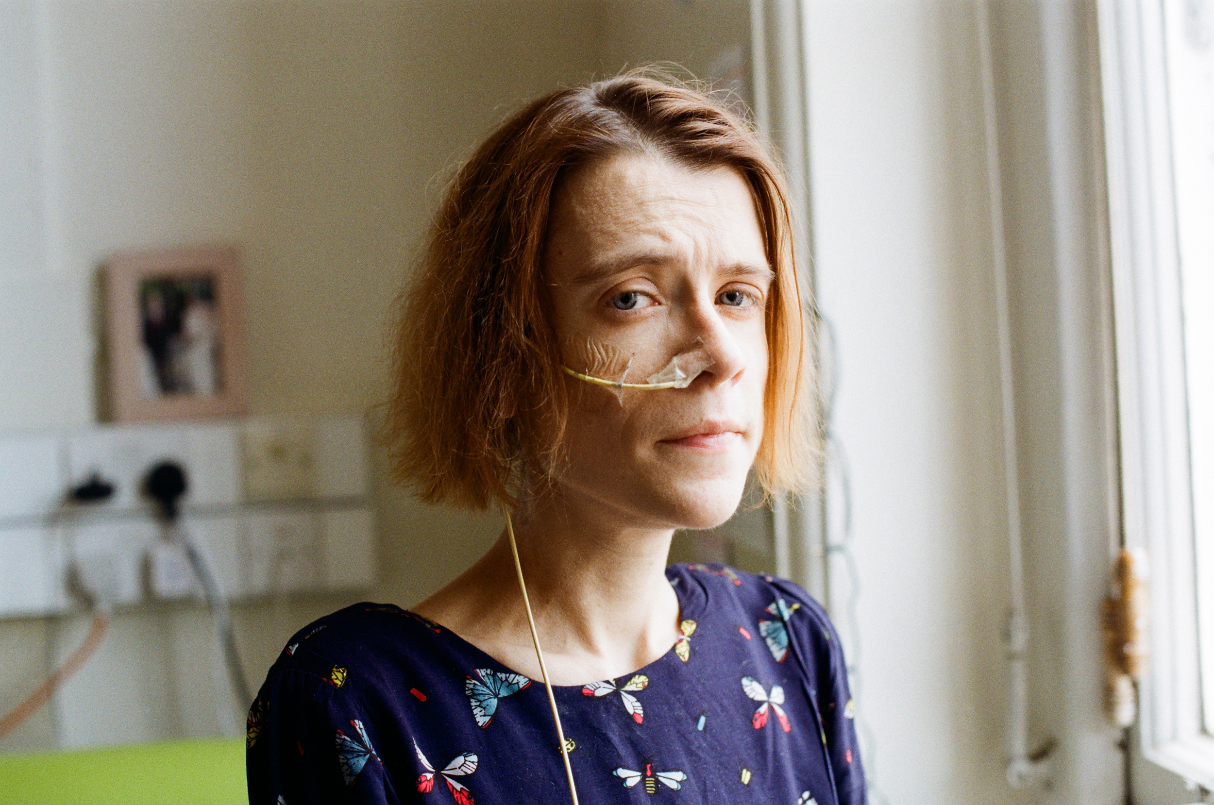  "Unfortunately I did have three miscarriages resulting from the IVF the last one being not this April, the April before and the first one was on my birthday, that’s how much my body hates me. That was fairly traumatic for both me and my husband and I think once we had the last miscarriage I kind of gave myself permission to start all that behavior again.. the psychiatrist I’m seeing thinks I’m just cross with my body for not doing what it should and I’m trying to punish it.” - Emma