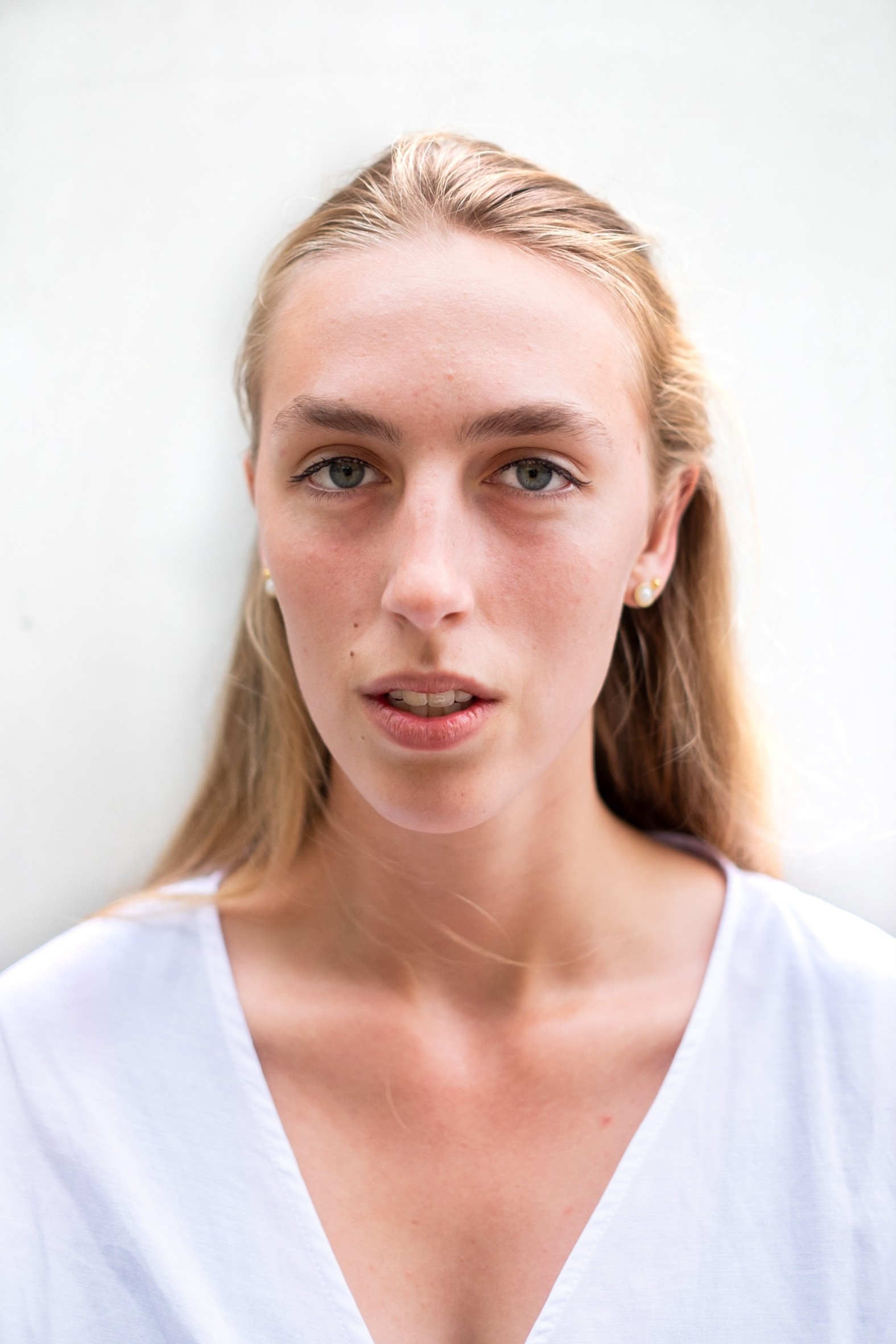 Deze jongeren zijn dolblij dat ze iets lieten doen aan hun gezicht