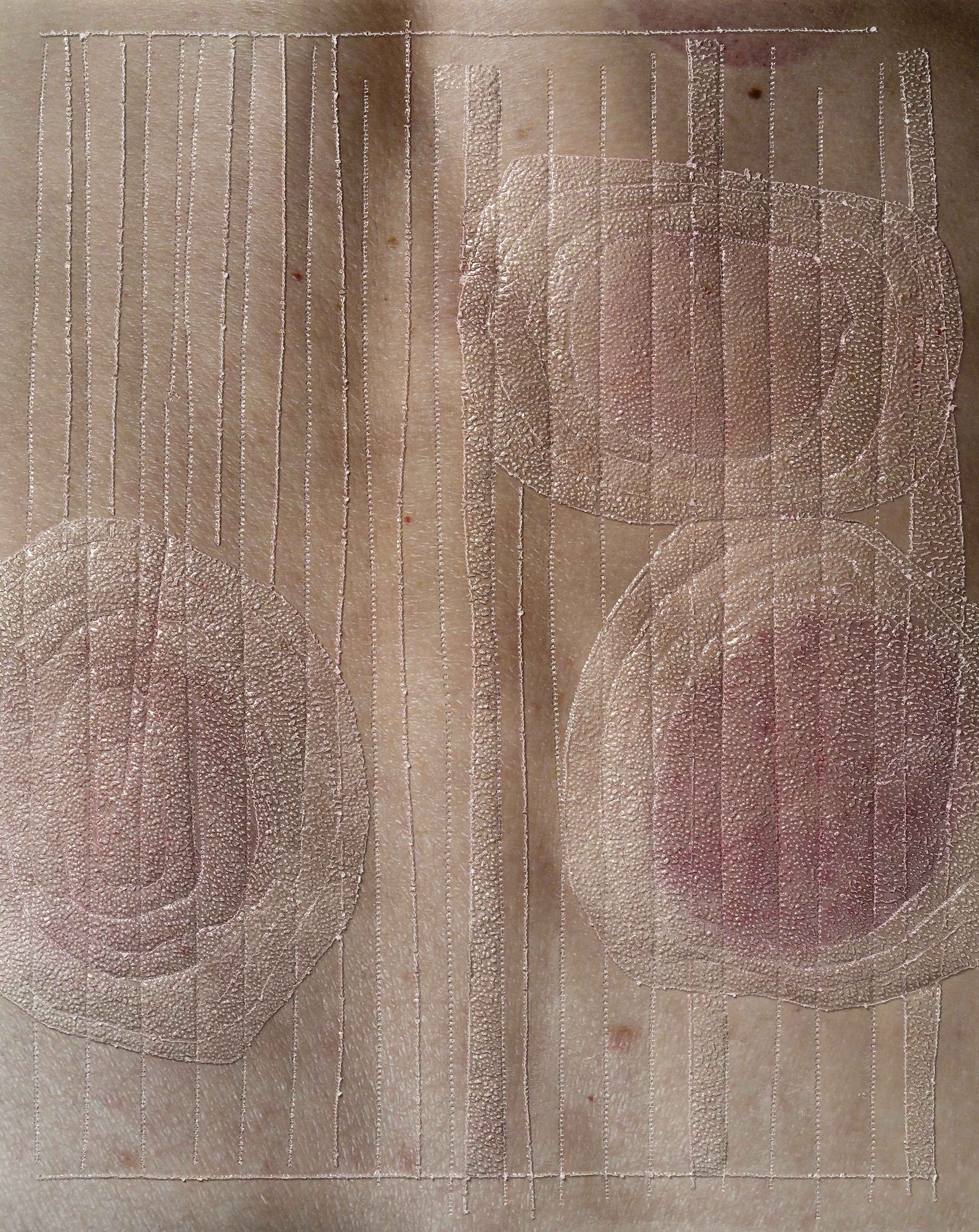 Sweet Bruises, 2014 . Perforation on photograph, 35 x 25 cm