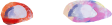 eyewhite