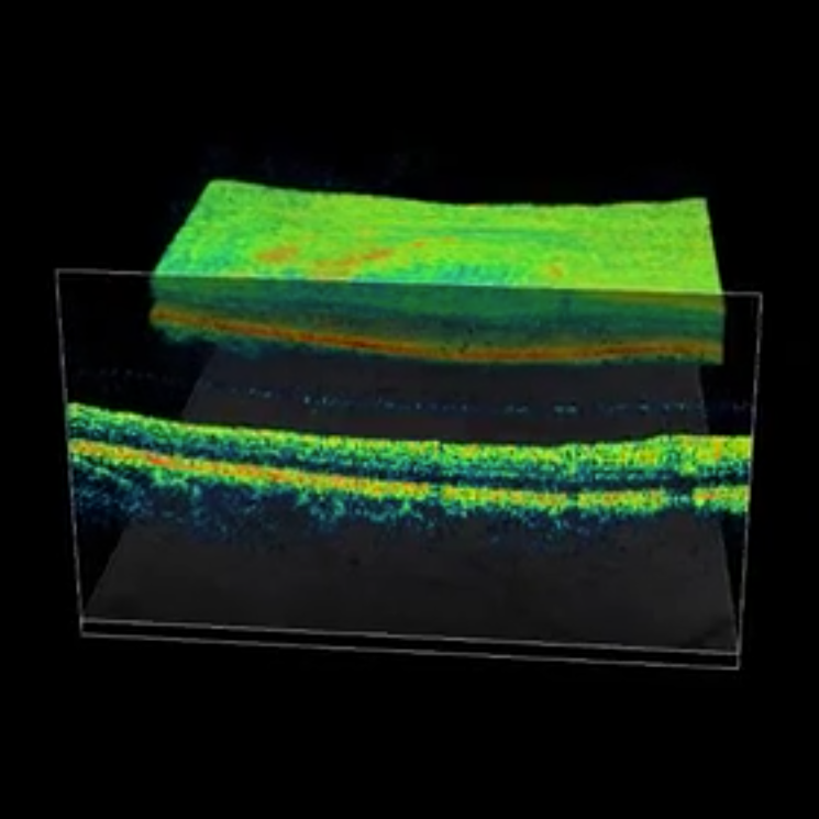 Ocular Visions Macula Box