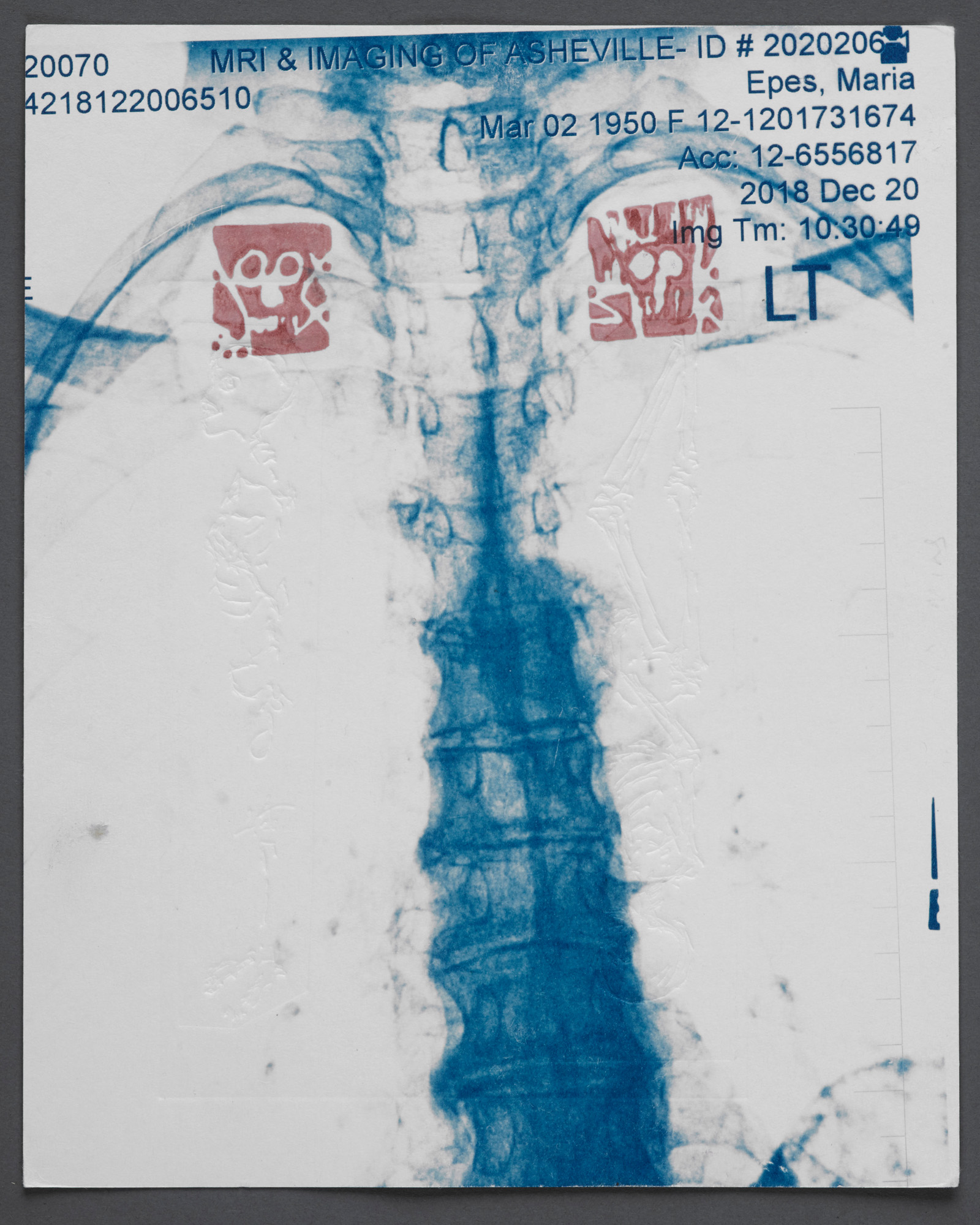 Spine & Shoulders - 2020 - Cyanotype on 100% cotton acid-free paper - 8” x 10"