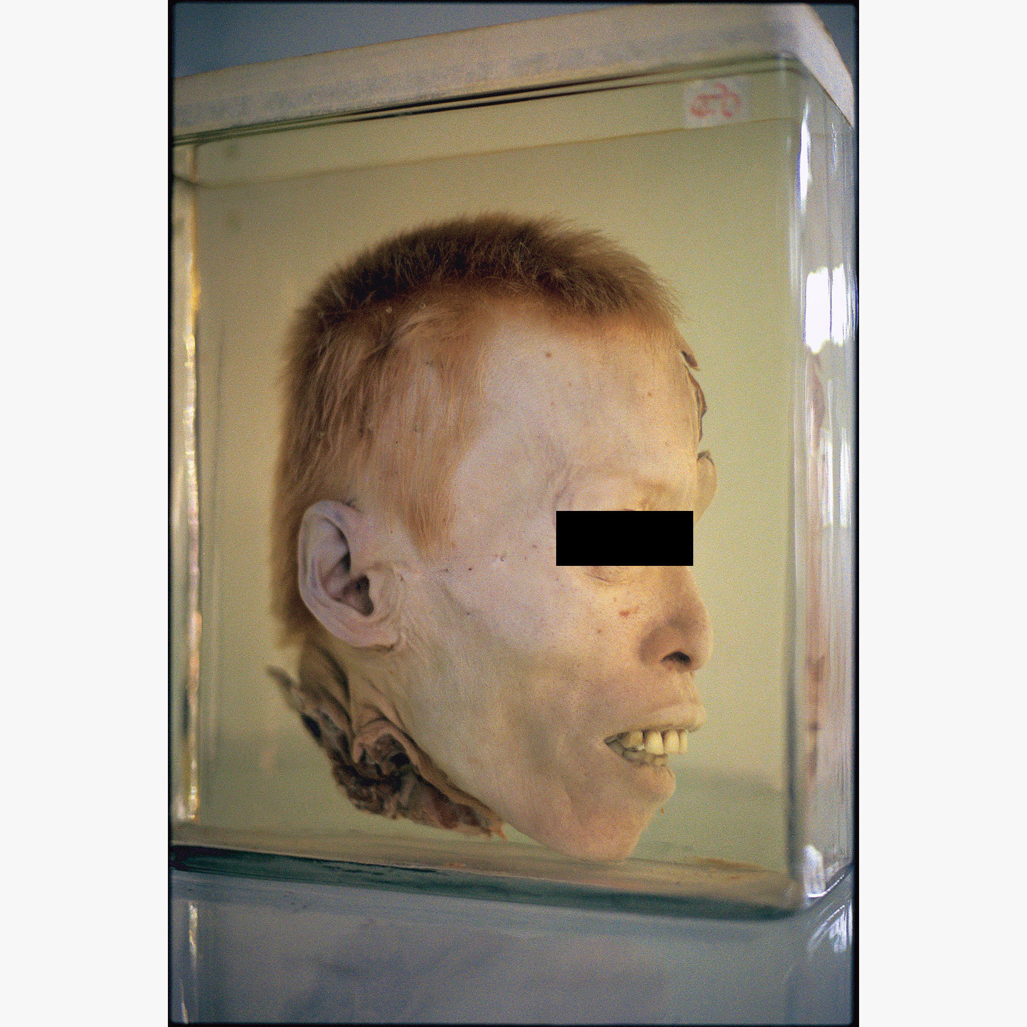 2/4พิพิธภัณฑ์การแพทย์ศิริราช, 2000 (001227_025a)