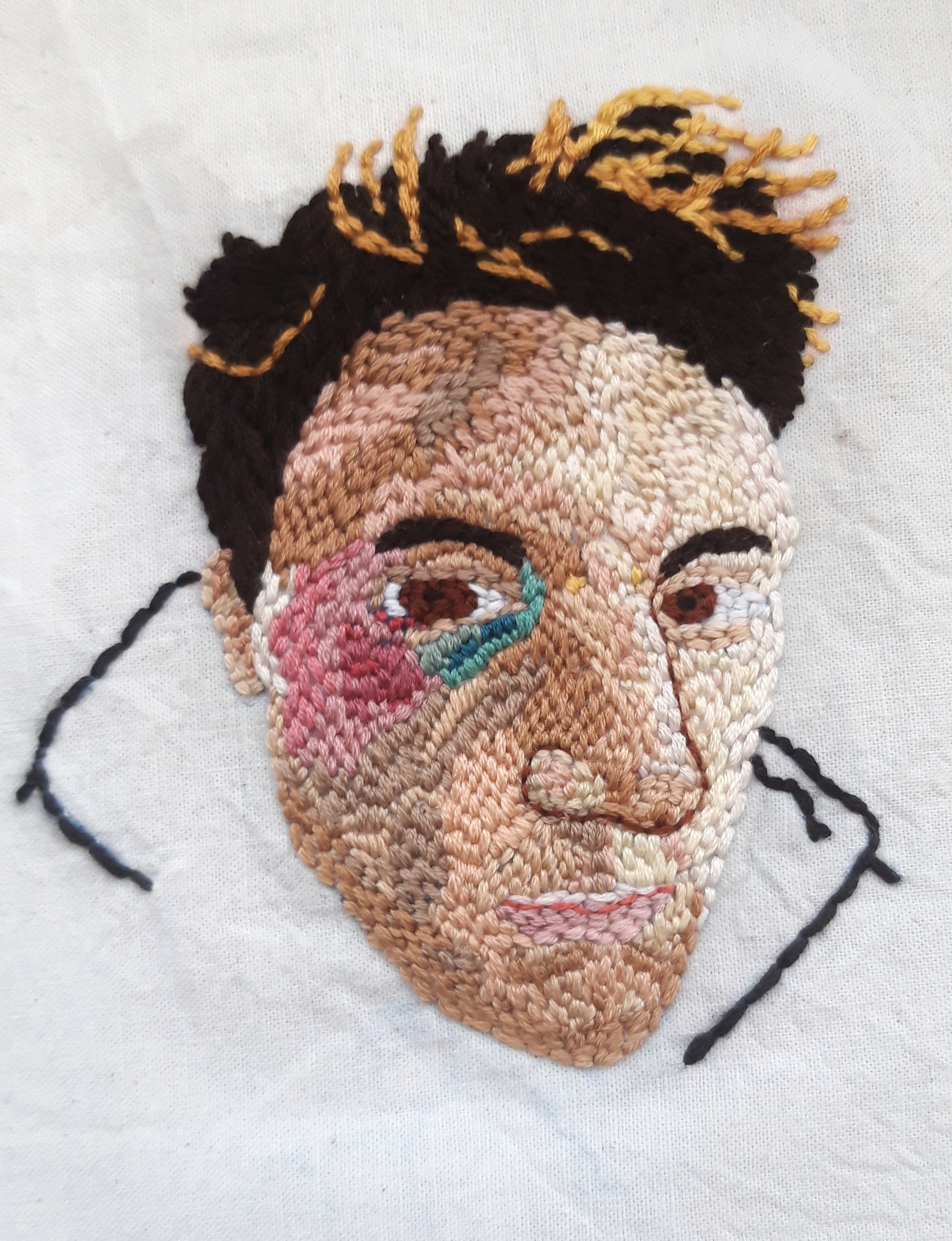 Selfportrait with black eye
