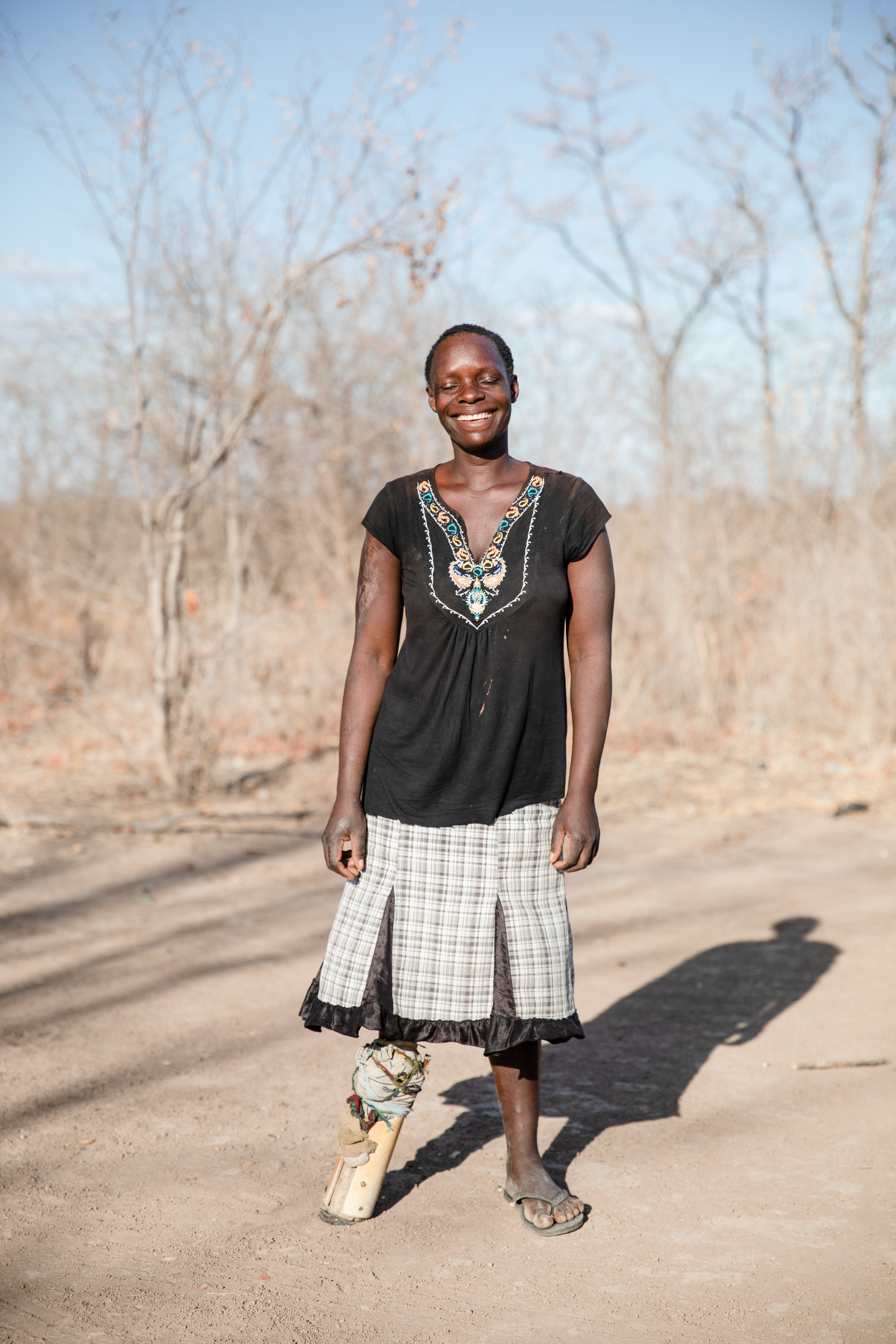 "As a Red Cross volunteer I have learnt things like first aid. I have taught others how to build cook stoves and keyhole gardens and they have eagerly accepted this knowledge without any reservations about my physical outlook."