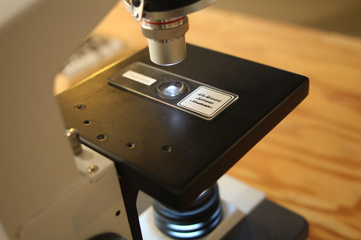 Aberrations – Microscope, slides, 2014