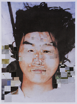 [IMAGE] After Suture