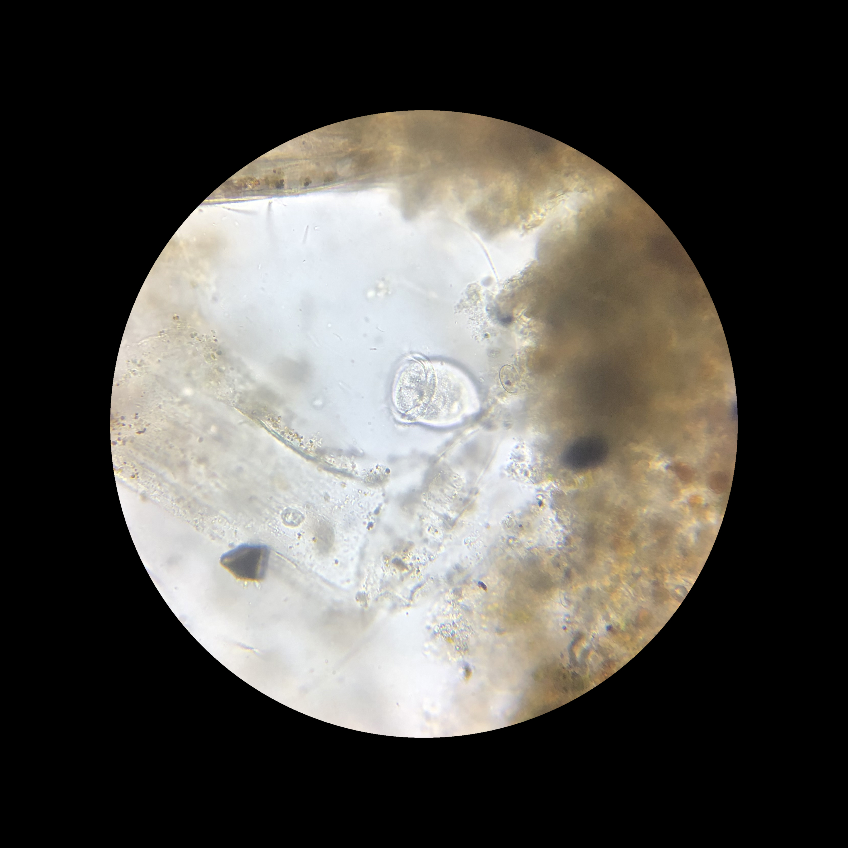 Vorticella