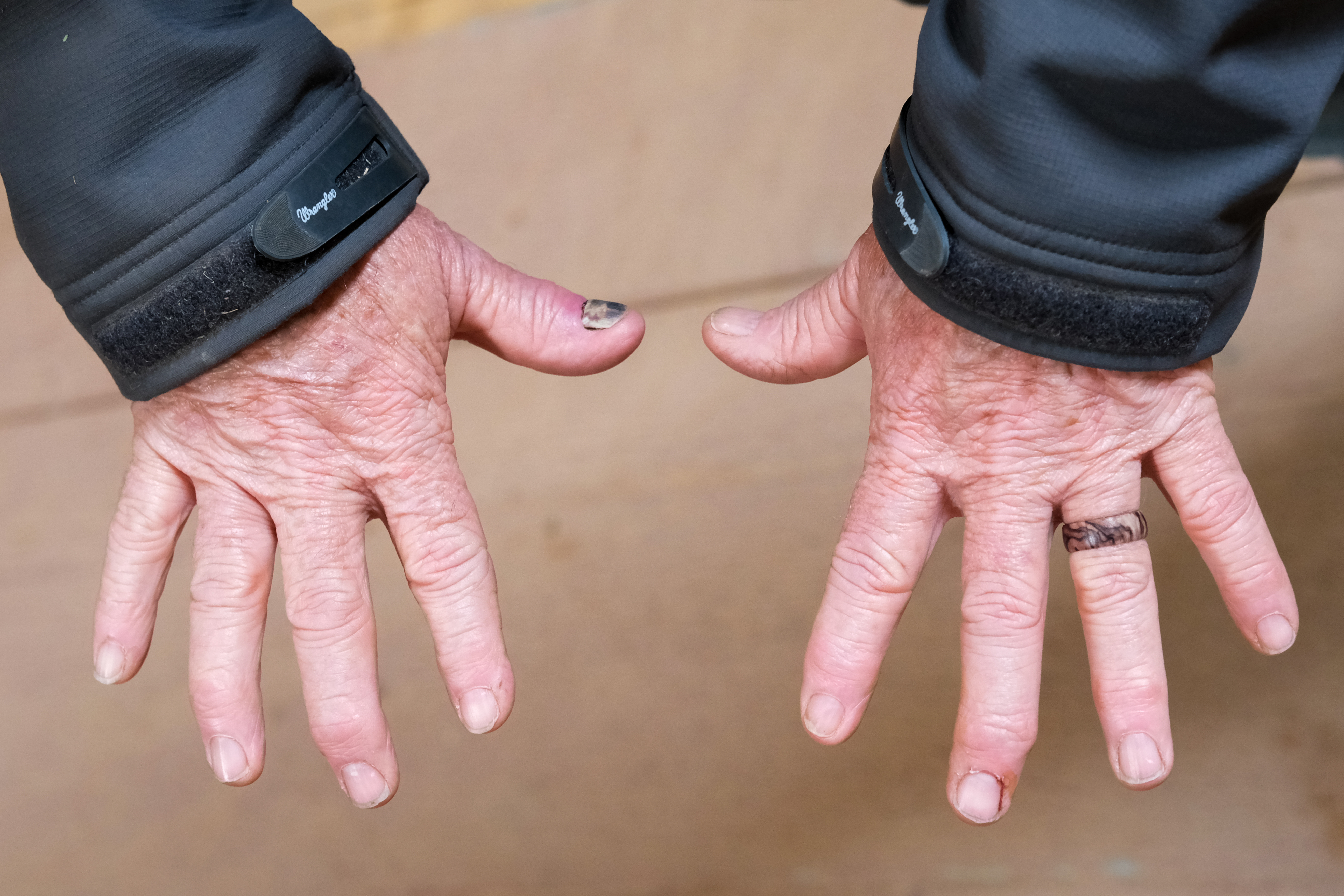 Pastor Russ shows us his finger injuries. He used to be a professional calf roper before starting a cowboy church in Alvarado, TX.