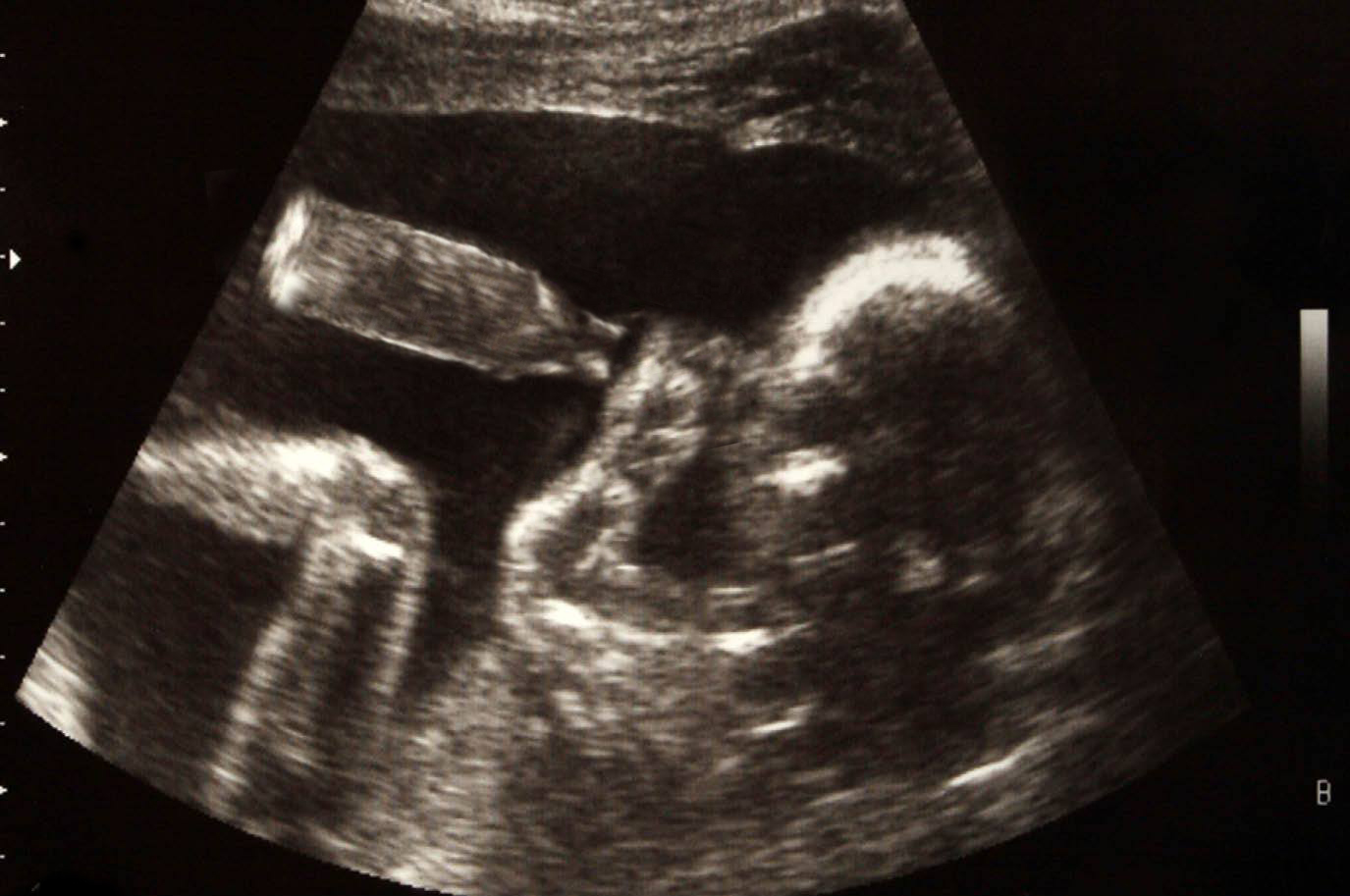 Ребенок на 22 неделе беременности фото