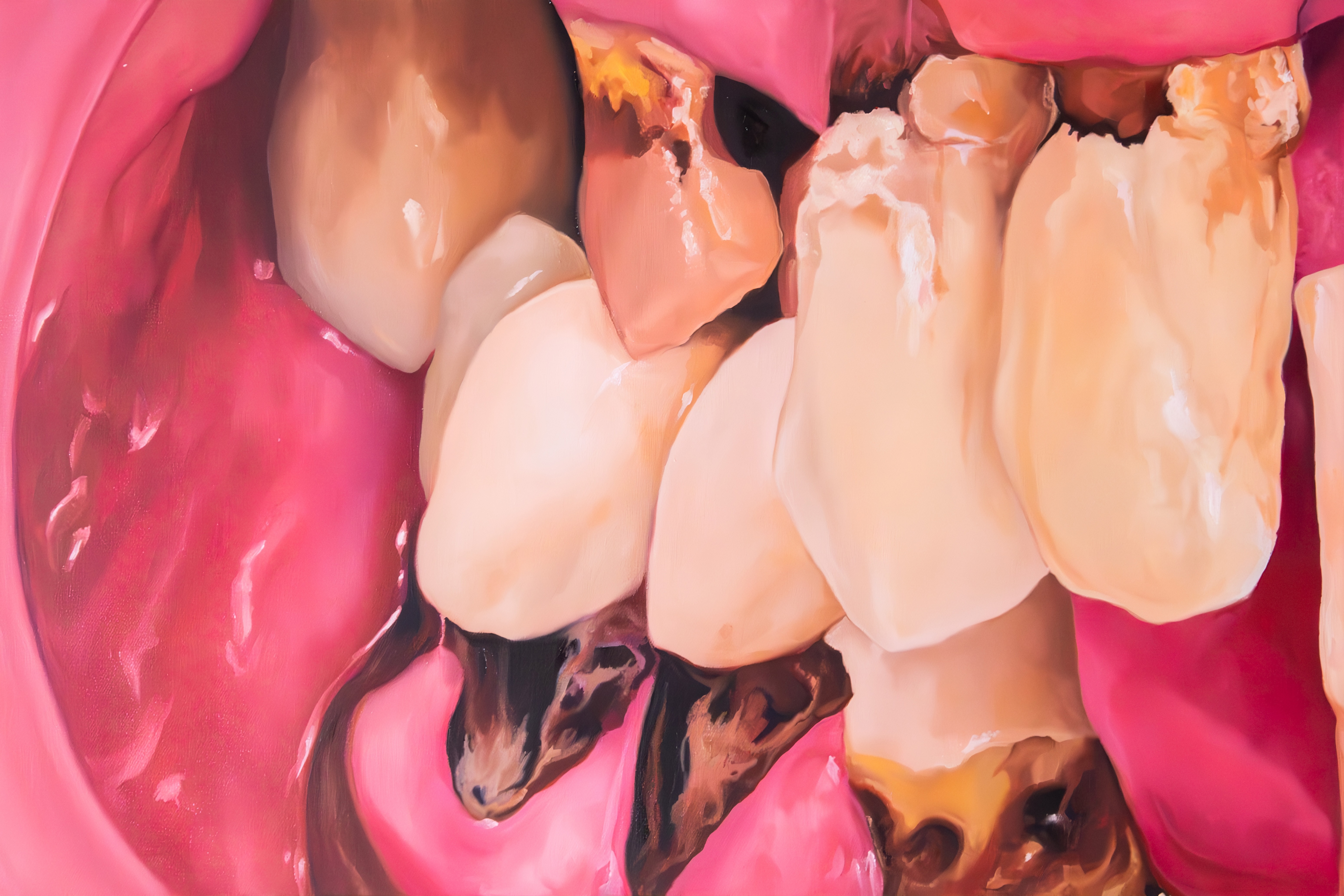  Bite Record #2: Necrotic Bloom