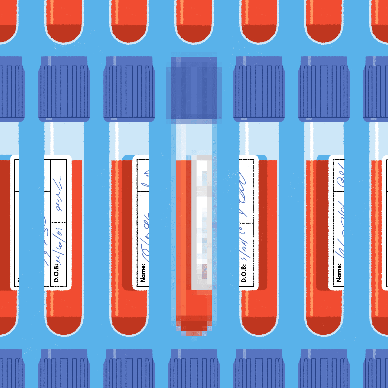 New Alzheimer Blood Test