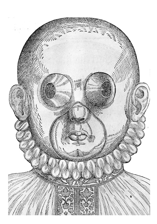 Georg Bartisch, "Ophthalmodouleia", 1583 © Wellcome Collection