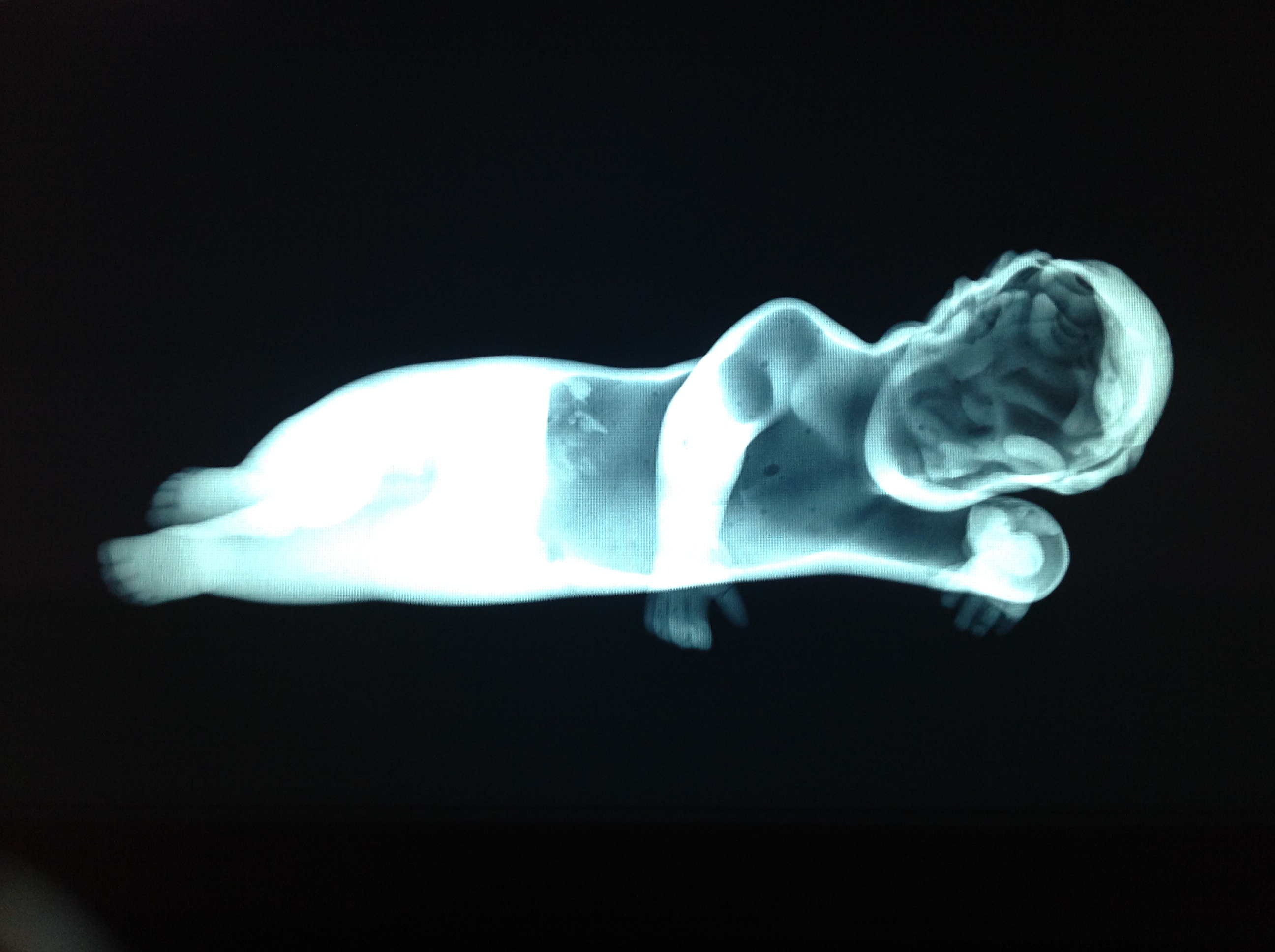 Fig.75. X-ray of baby statue. For band Branco Blu. 2015.